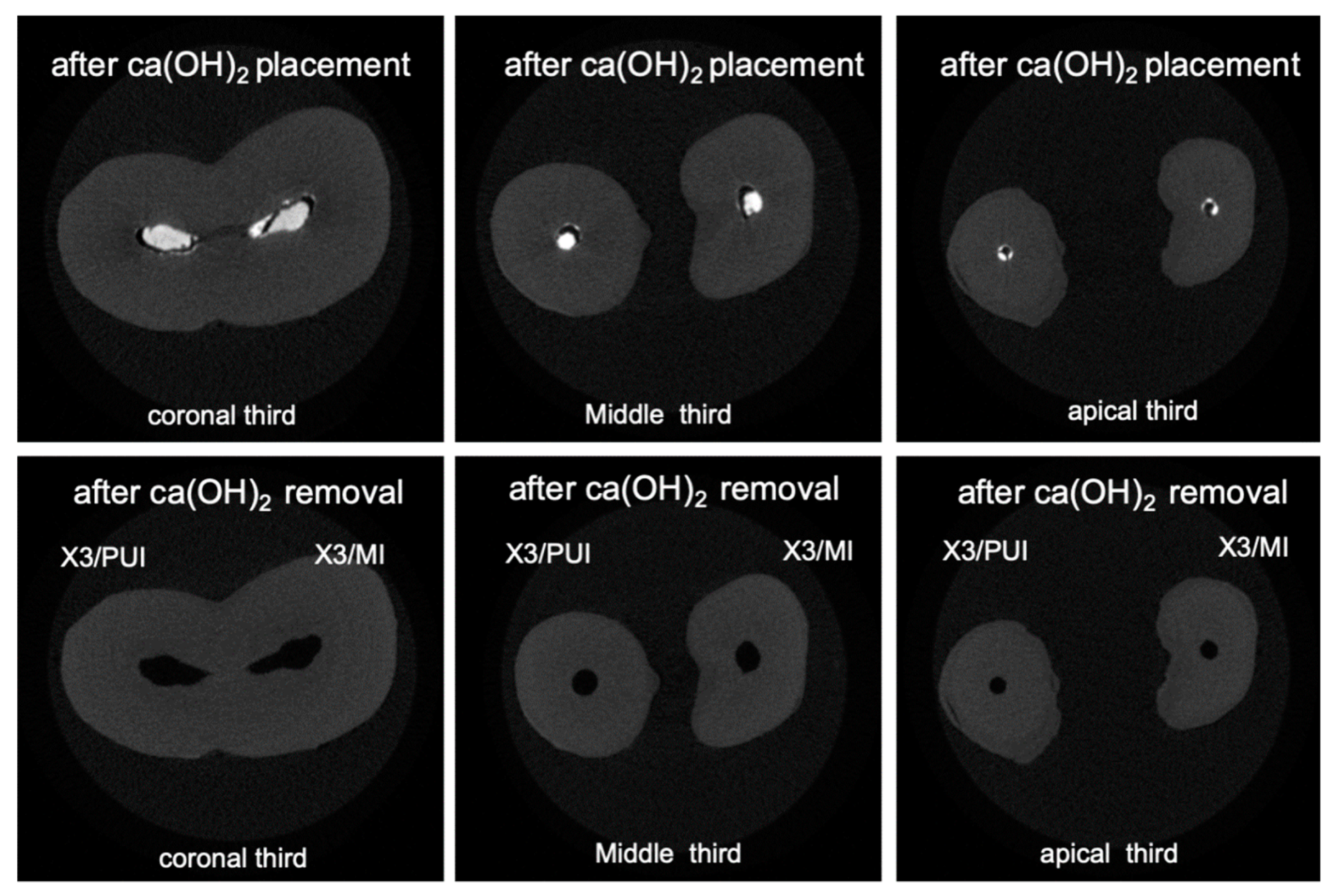 Materials 13 02222 g004 Materials 13 02222 g004