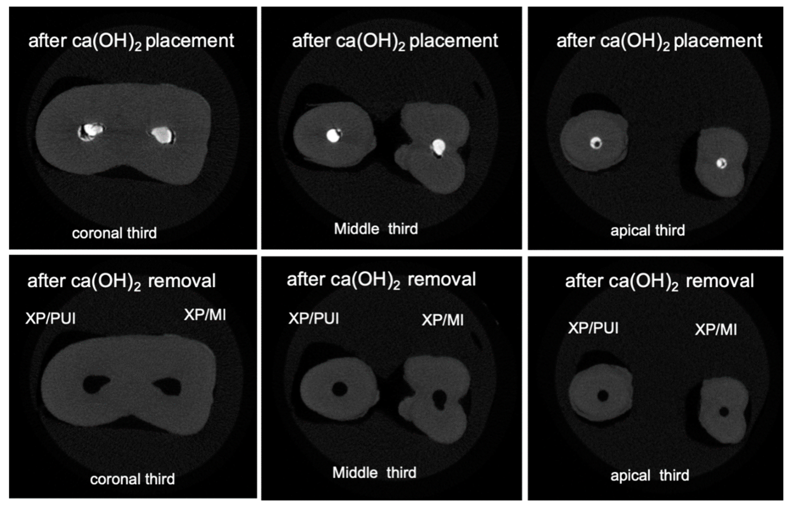 Materials 13 02222 g005 Materials 13 02222 g005