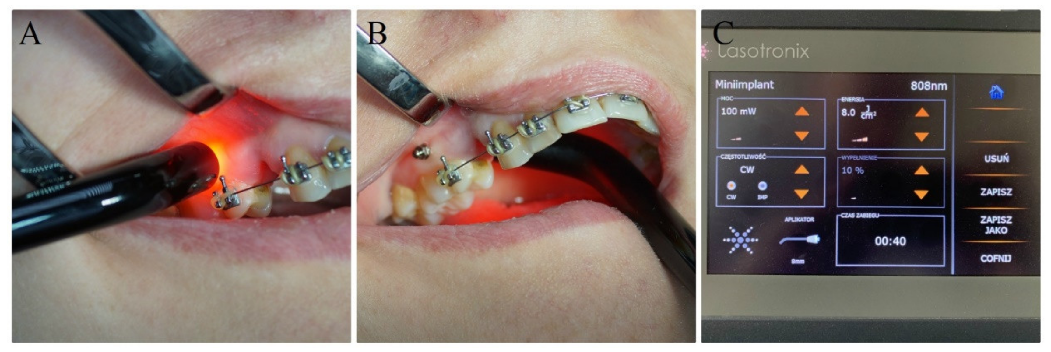 Materials 13 02265 g003 Materials 13 02265 g003