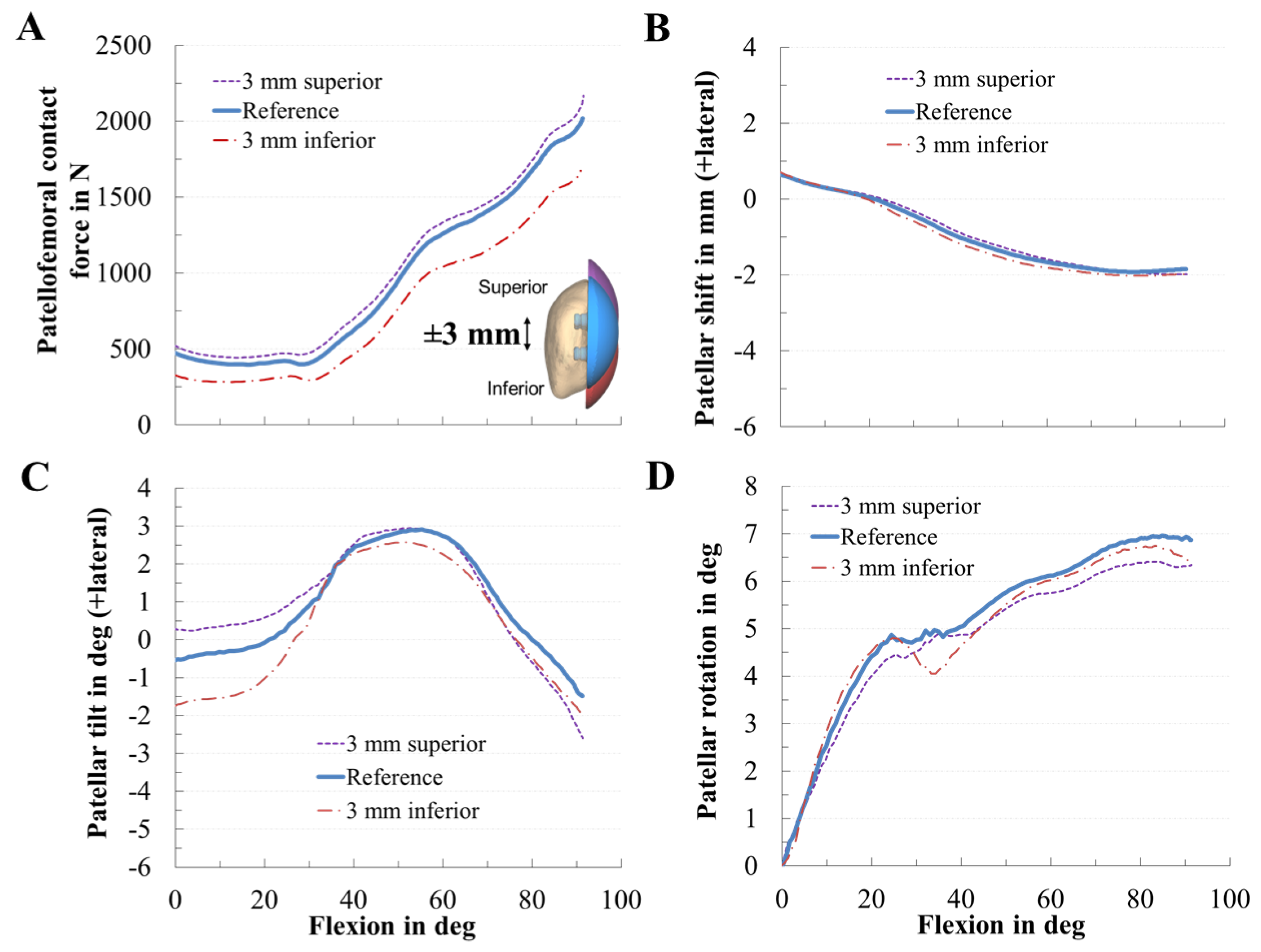 Materials 13 02365 g006