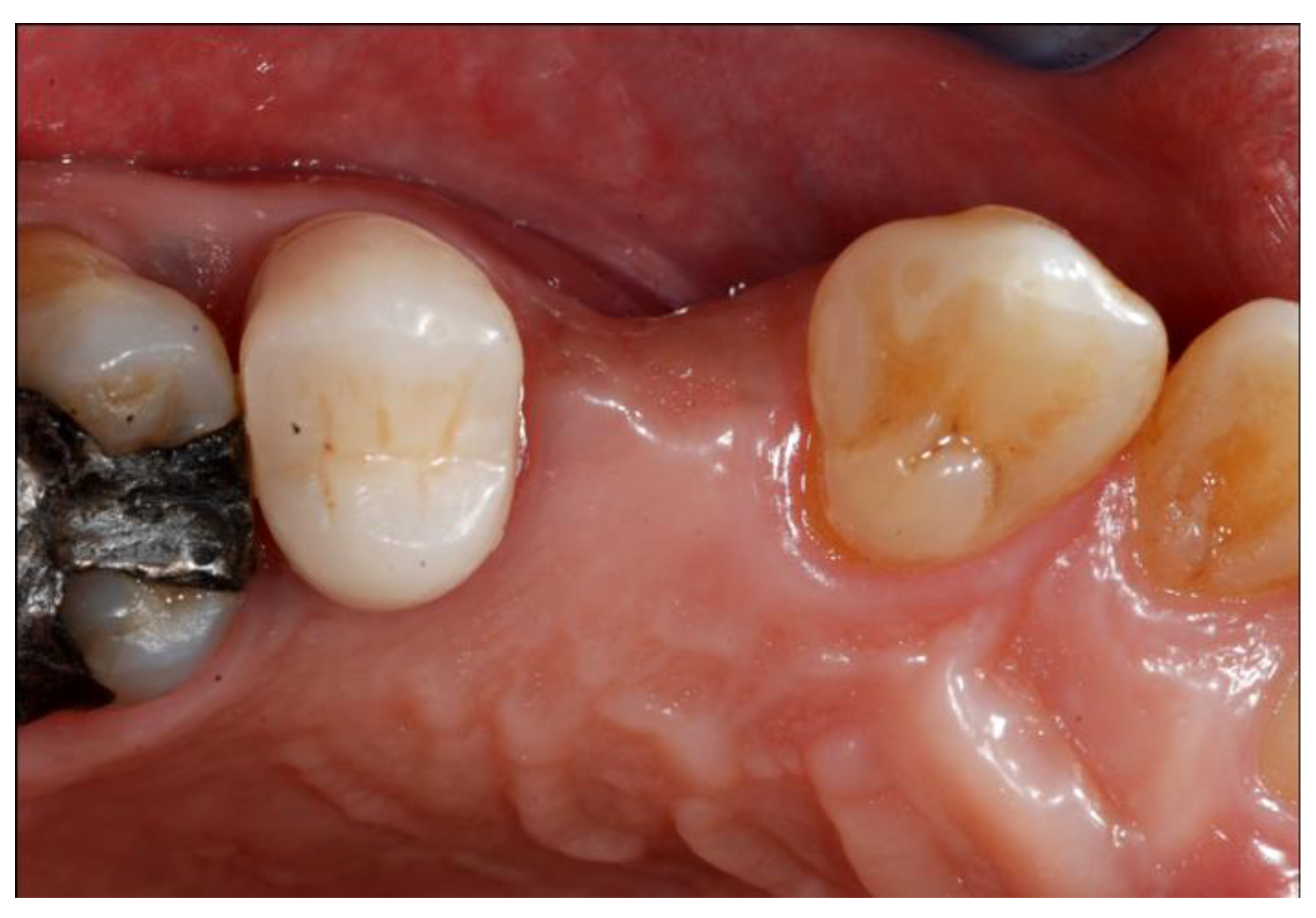 Materials 13 02389 g001 Materials 13 02389 g001