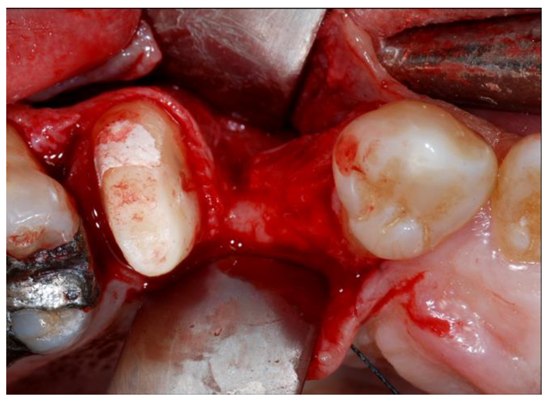 Materials 13 02389 g002 Materials 13 02389 g002