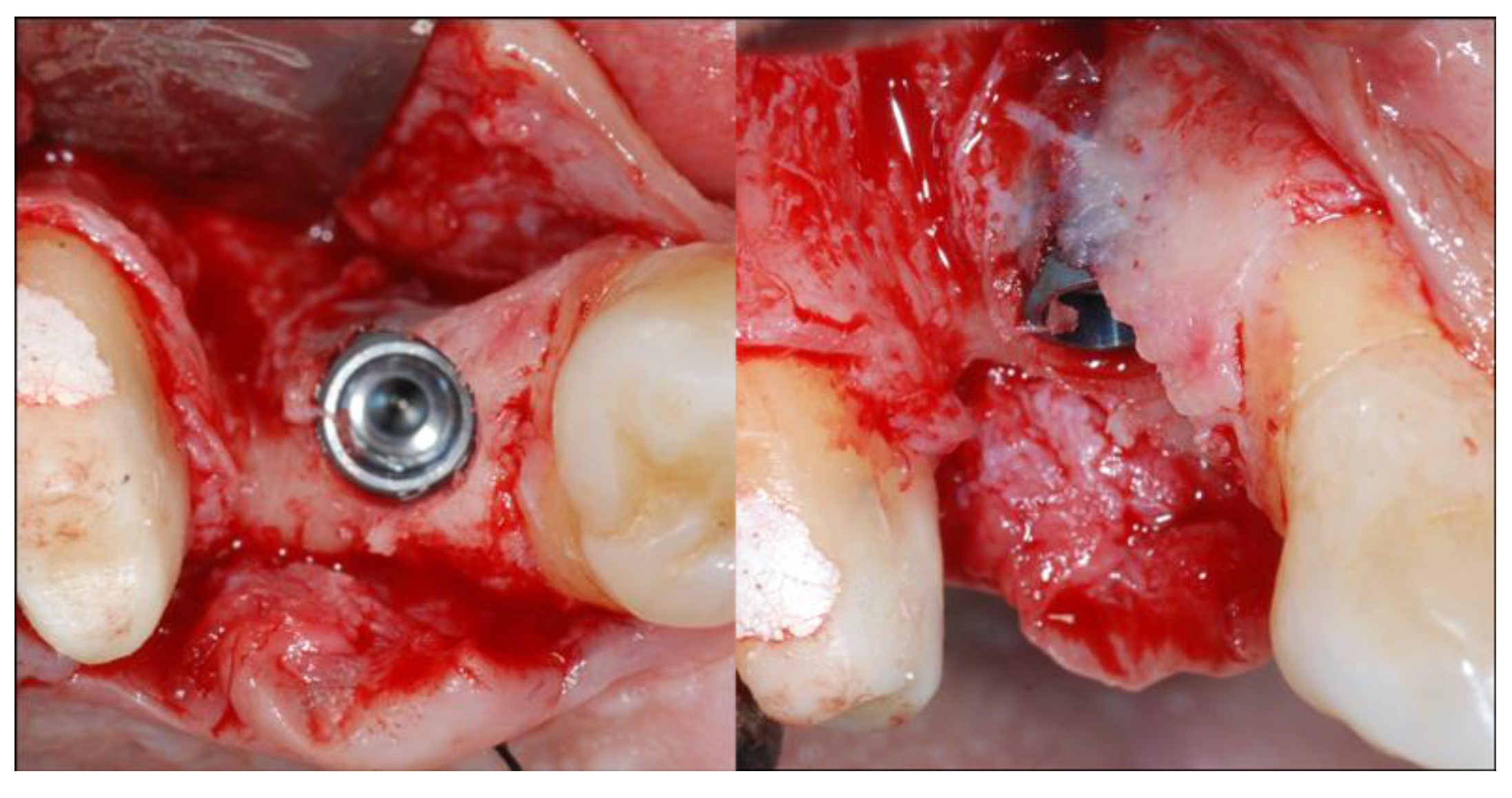 Materials 13 02389 g003 Materials 13 02389 g003