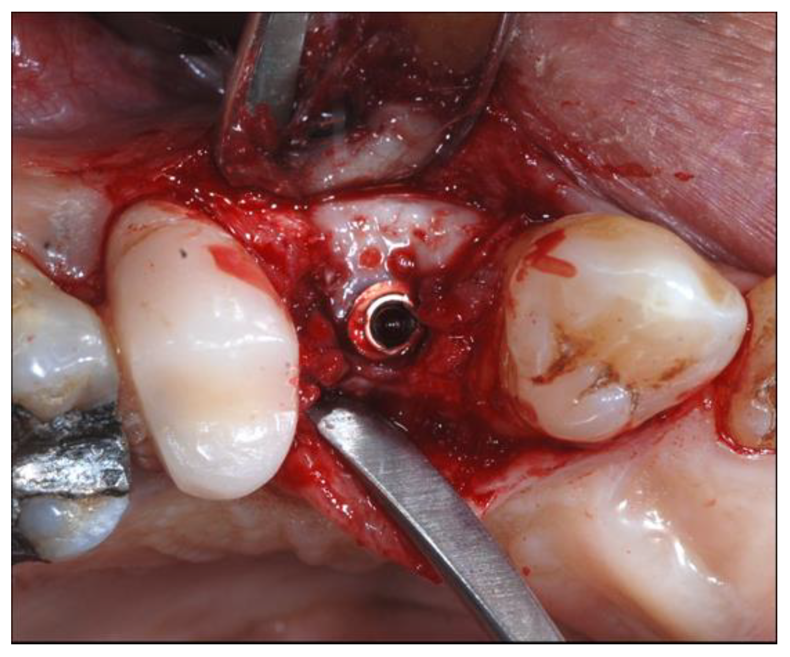 Materials 13 02389 g005 Materials 13 02389 g005