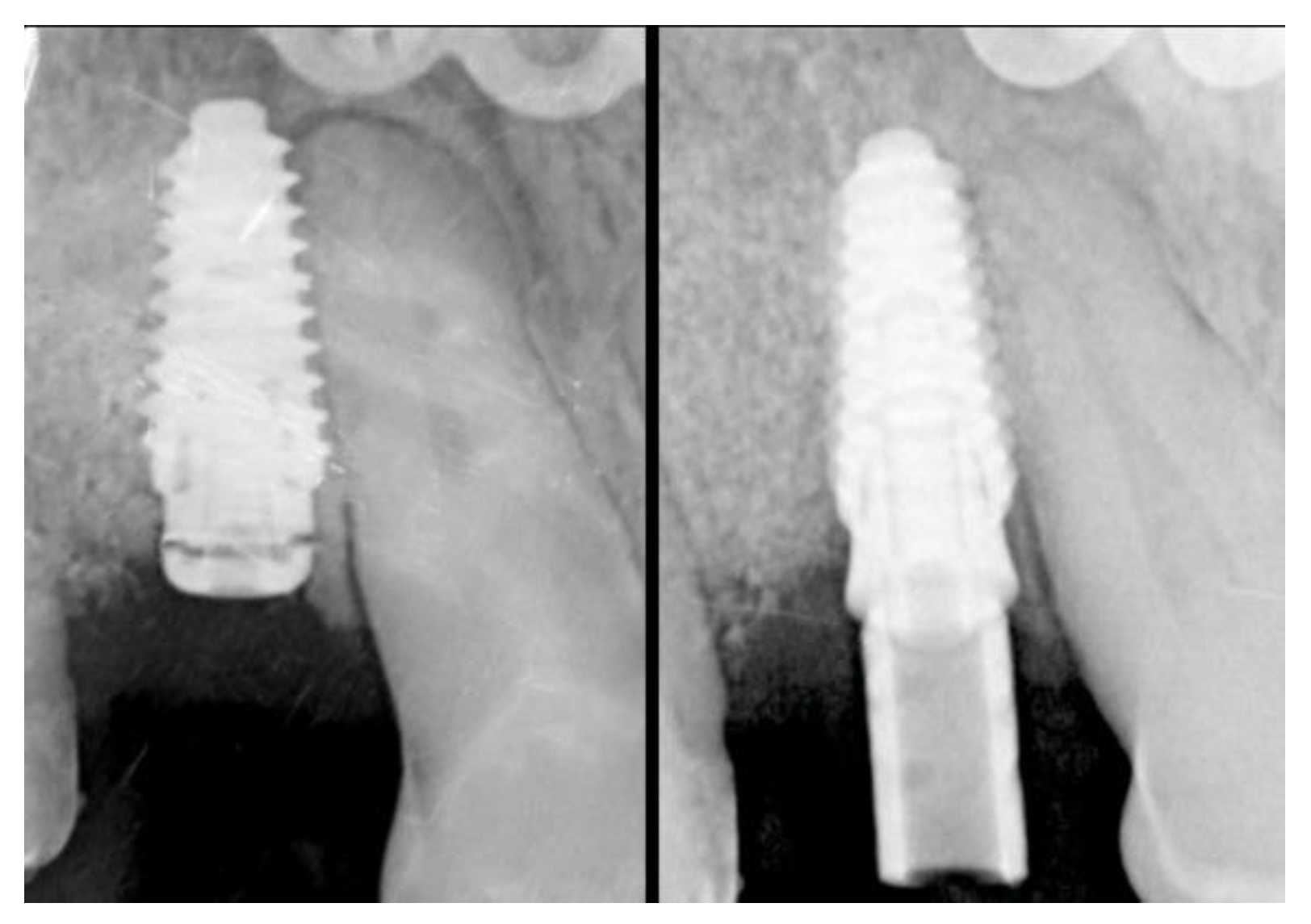 Materials 13 02389 g006 Materials 13 02389 g006