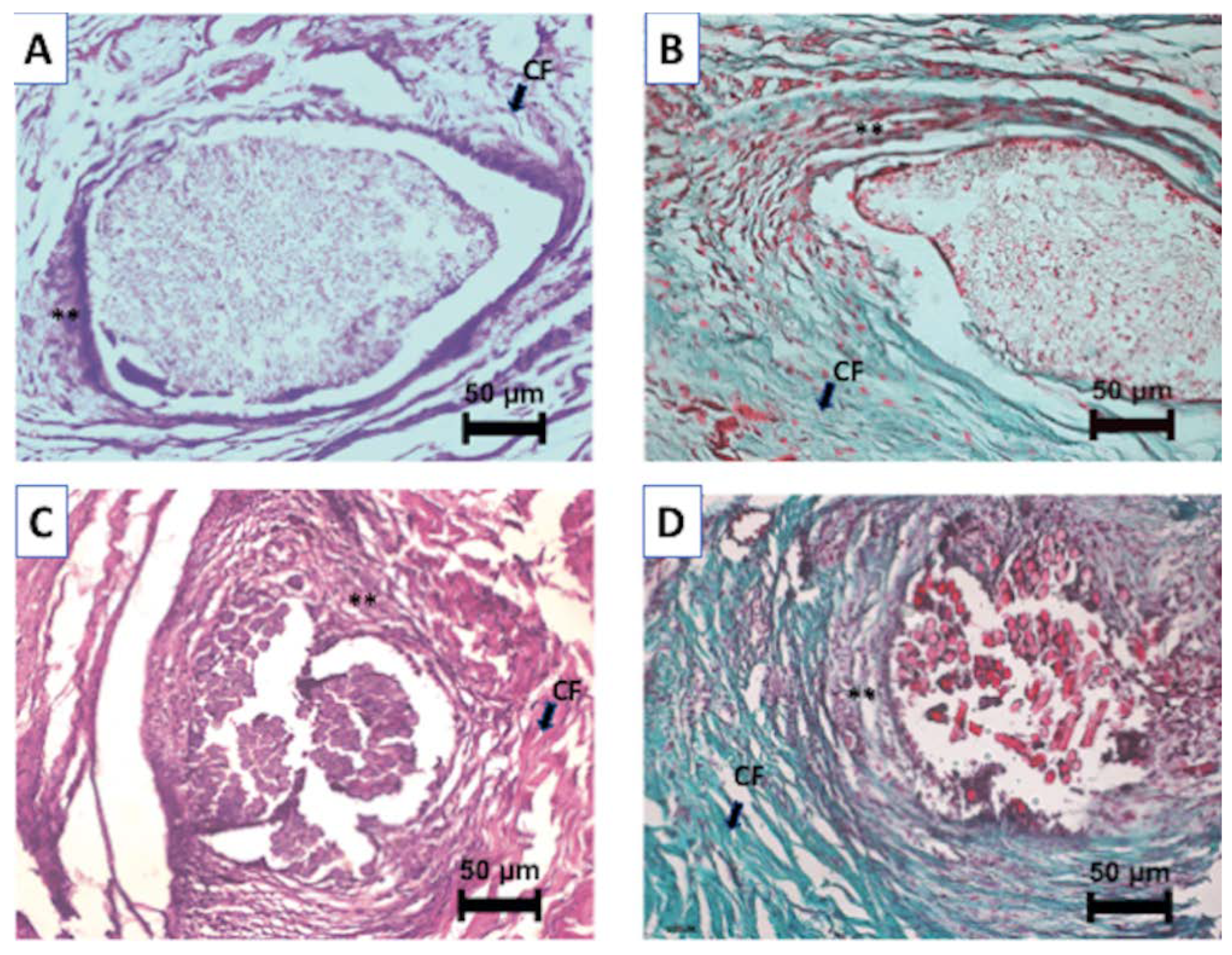 Materials 13 02497 g010 Materials 13 02497 g010