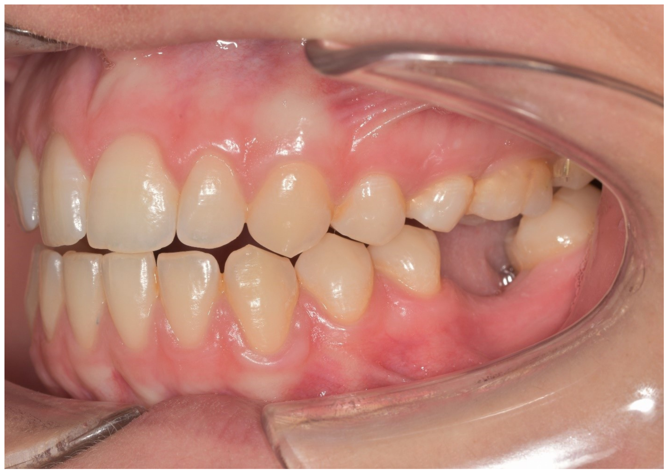 Materials 13 02781 g001 Materials 13 02781 g001