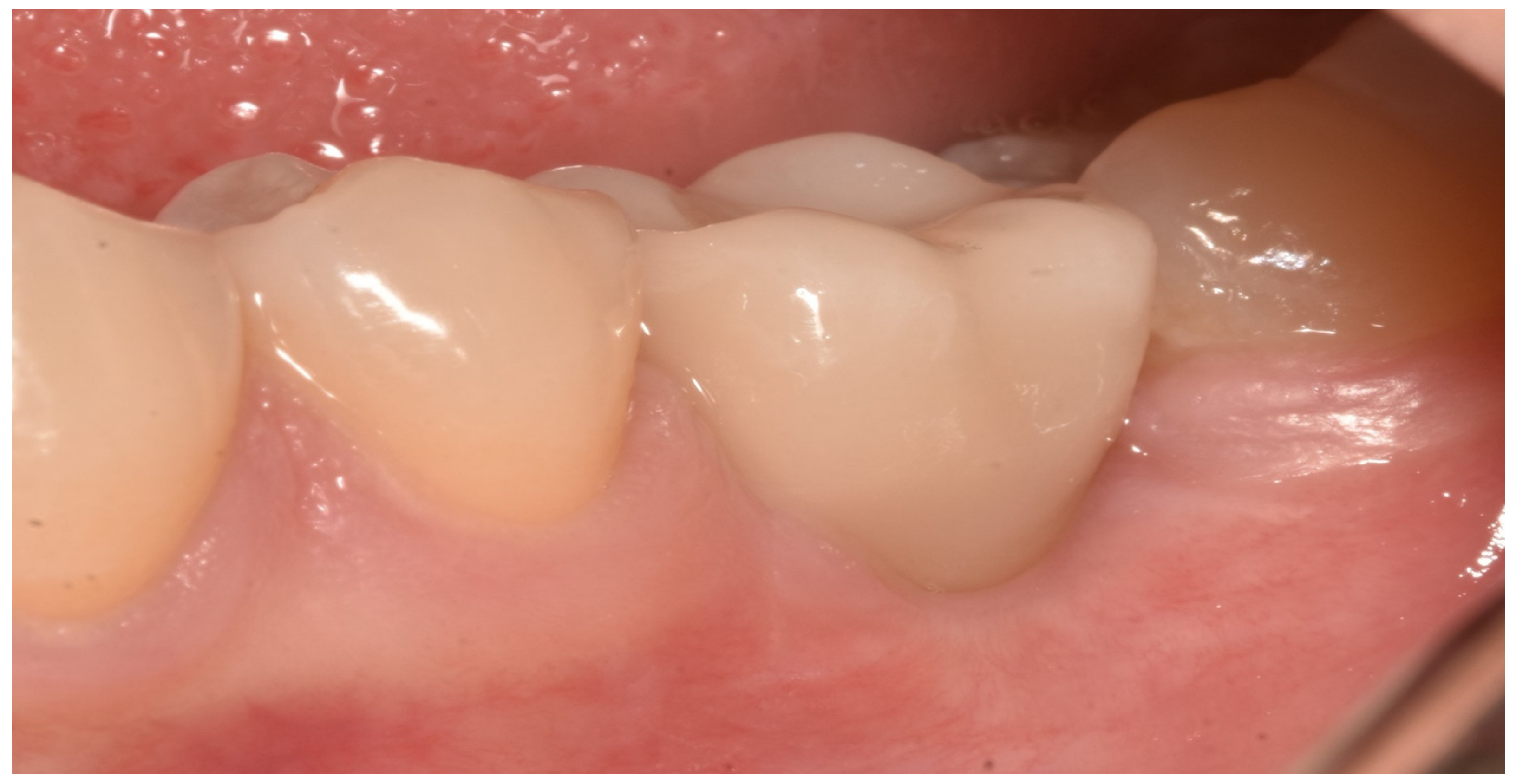 Materials 13 02781 g004 Materials 13 02781 g004