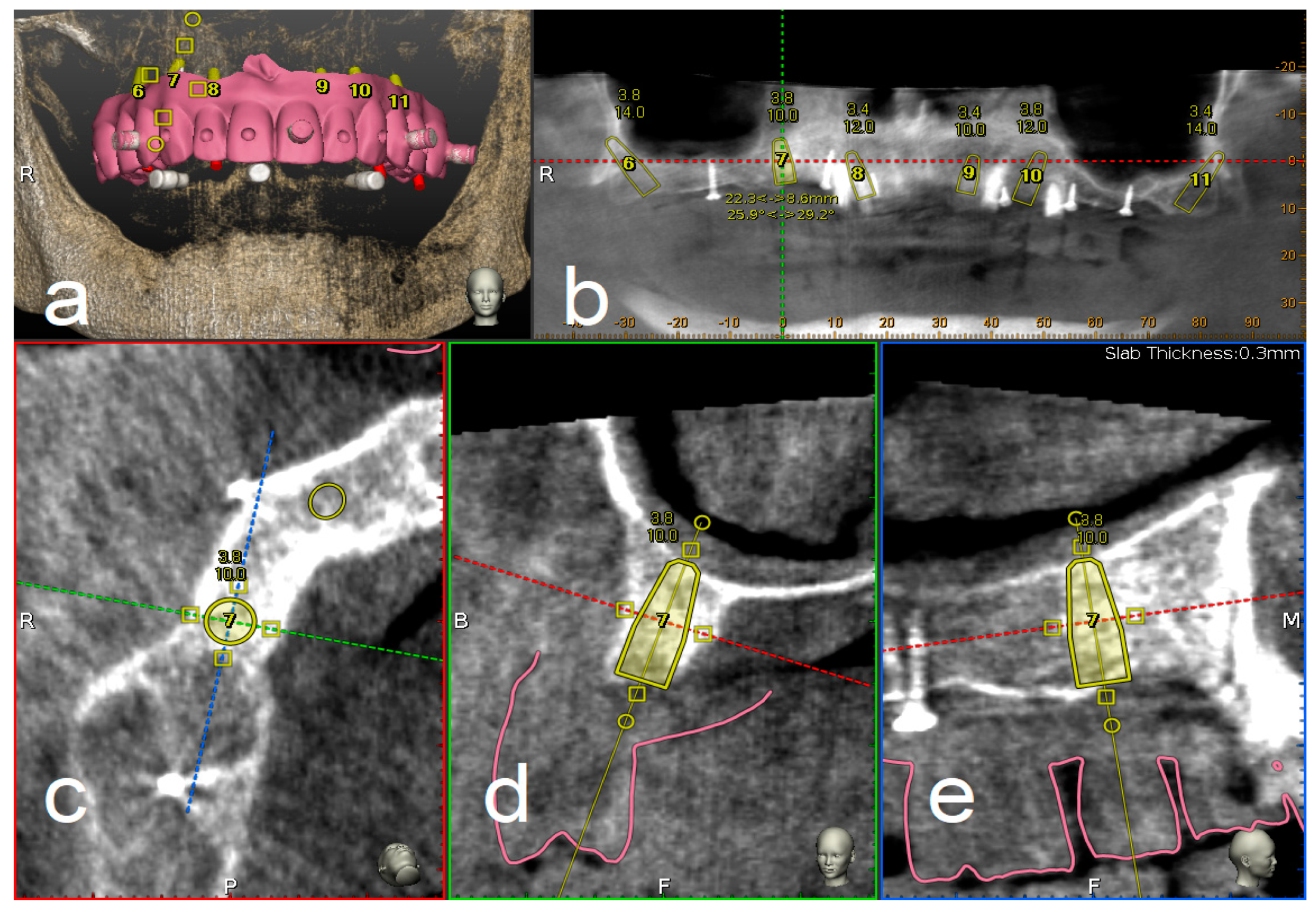 Materials 13 02806 g001 Materials 13 02806 g001