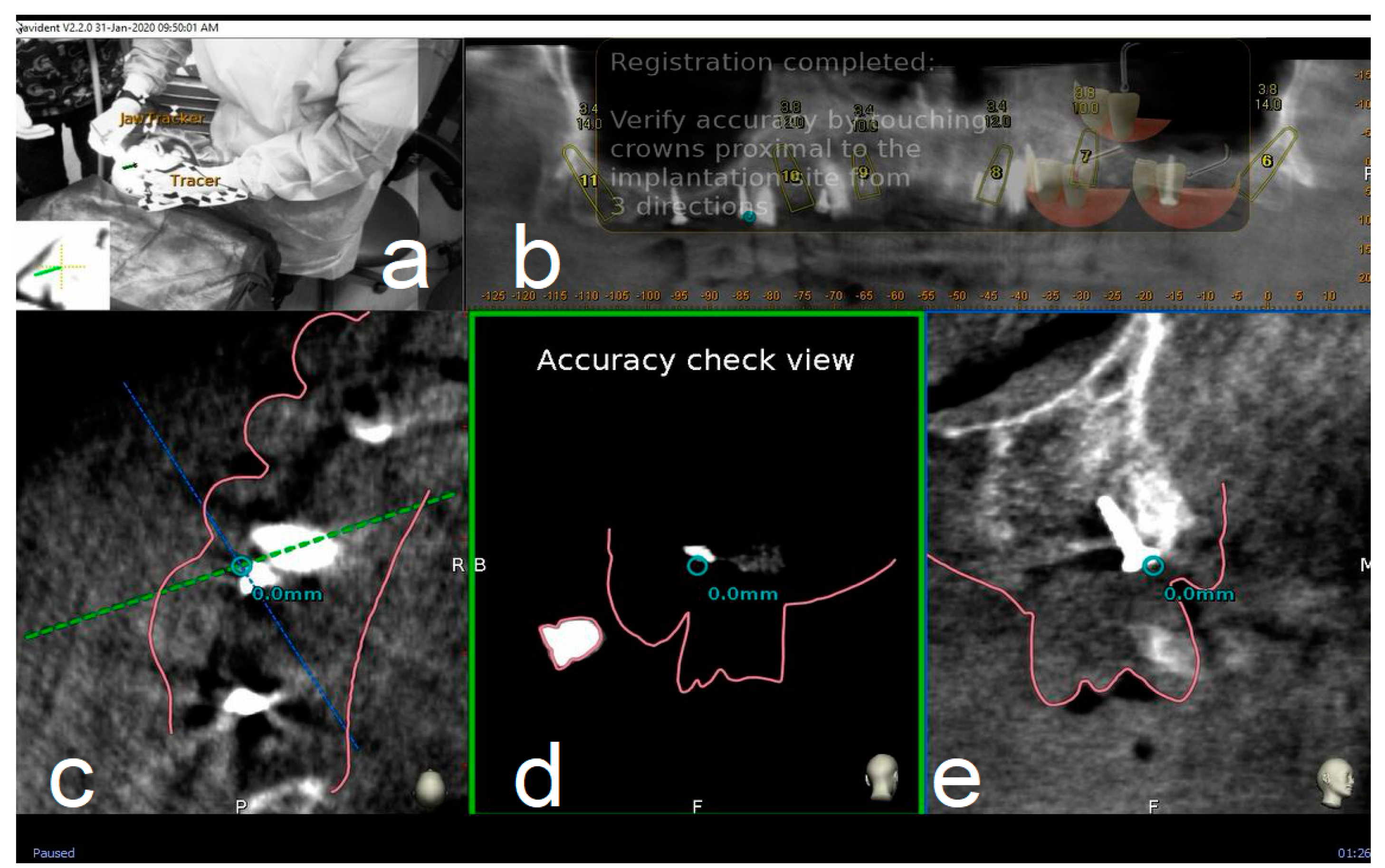 Materials 13 02806 g004 Materials 13 02806 g004