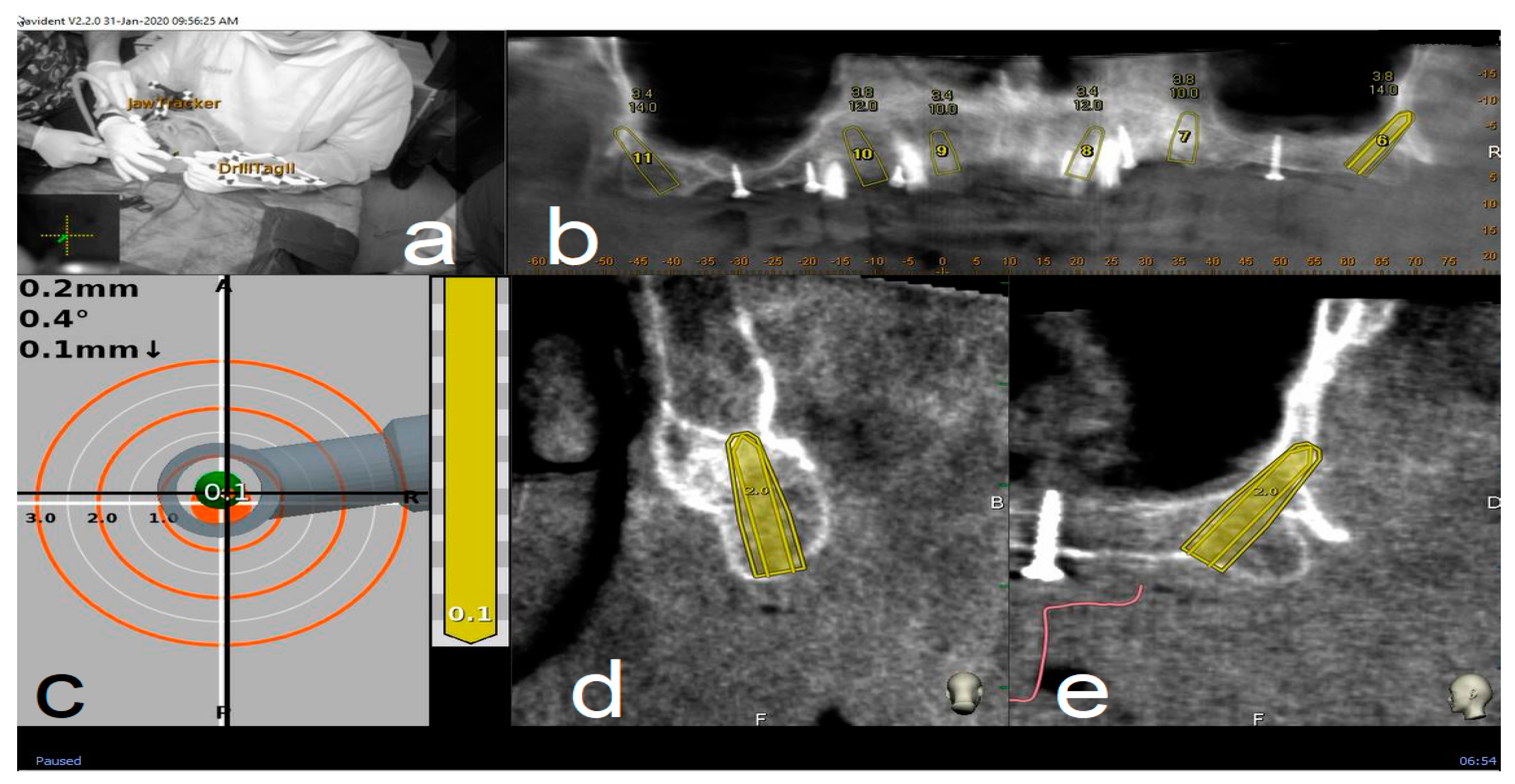 Materials 13 02806 g005 Materials 13 02806 g005
