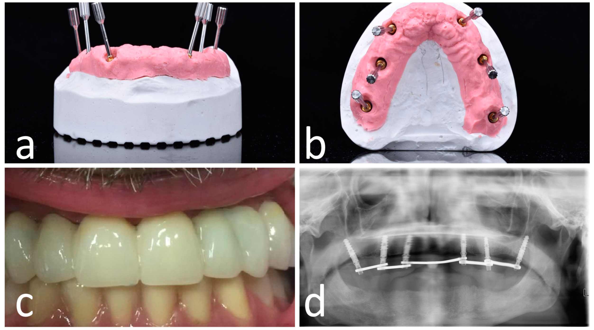 Materials 13 02806 g006 Materials 13 02806 g006