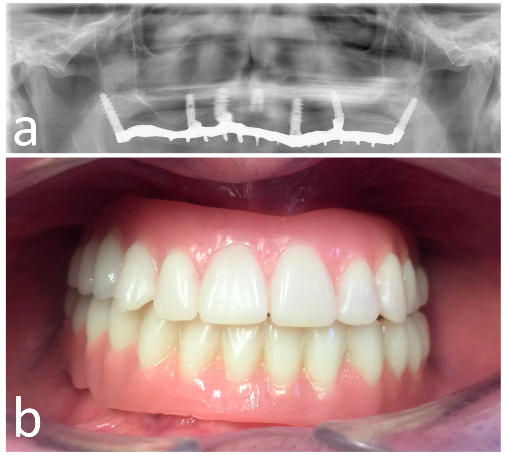 Materials 13 02806 g007 Materials 13 02806 g007