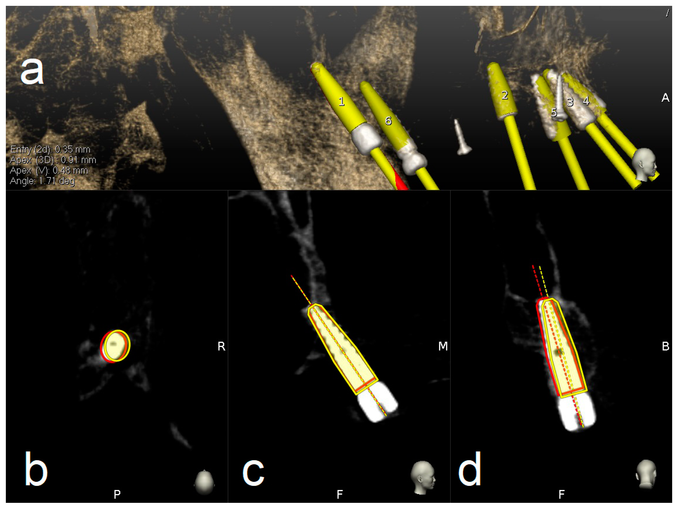Materials 13 02806 g009 Materials 13 02806 g009