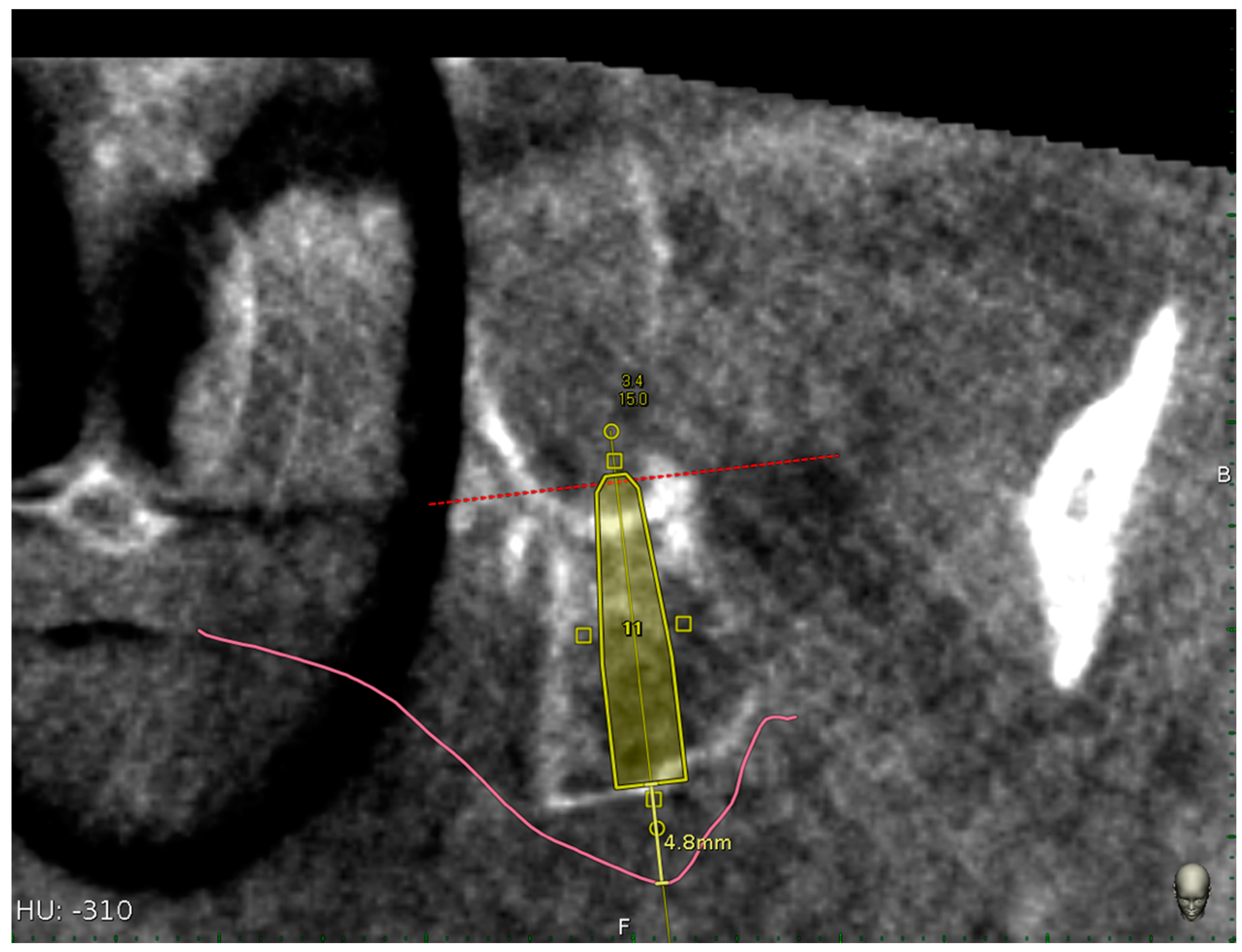 Materials 13 02806 g010 Materials 13 02806 g010