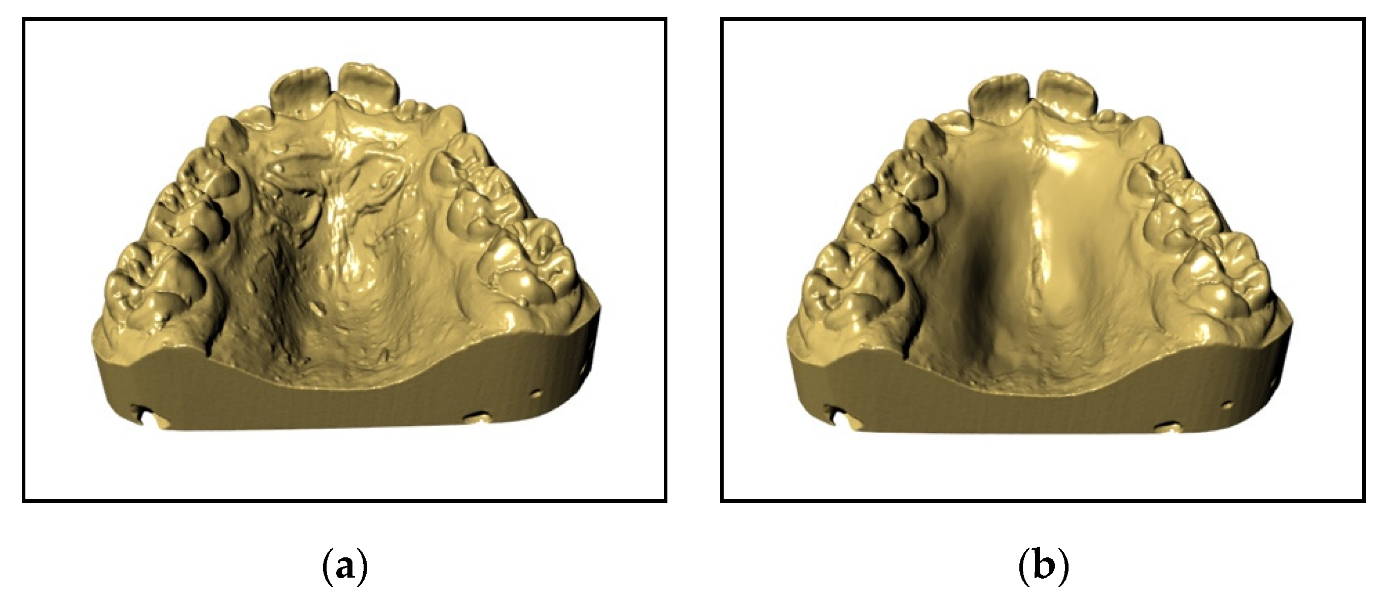 Materials Free Full Text A New Proposal A Digital Flow For The Construction Of A Haas Inspired Rapid Maxillary Expander Hirme Html