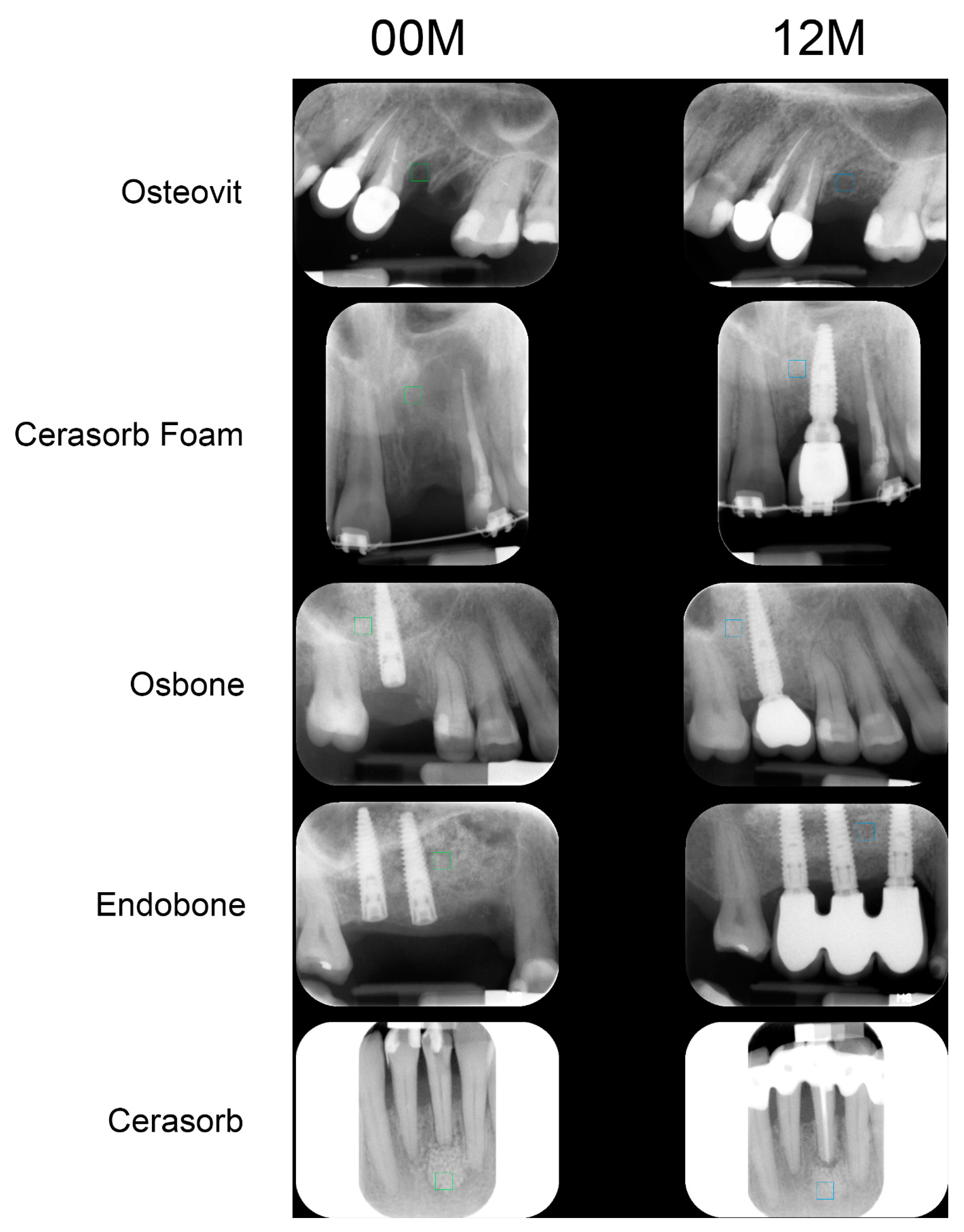 Materials 13 02935 g001