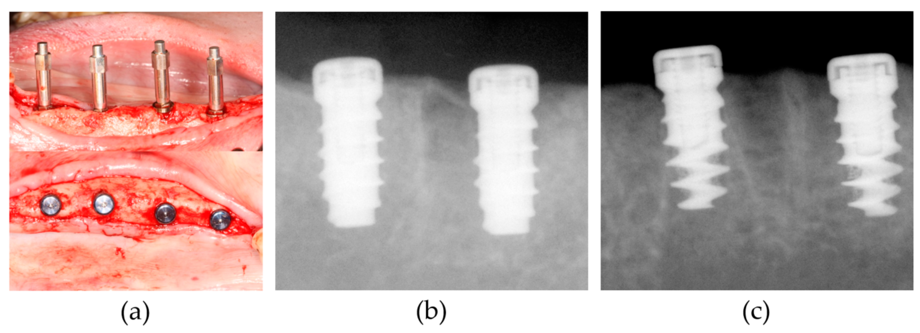Materials 13 03061 g003 Materials 13 03061 g003