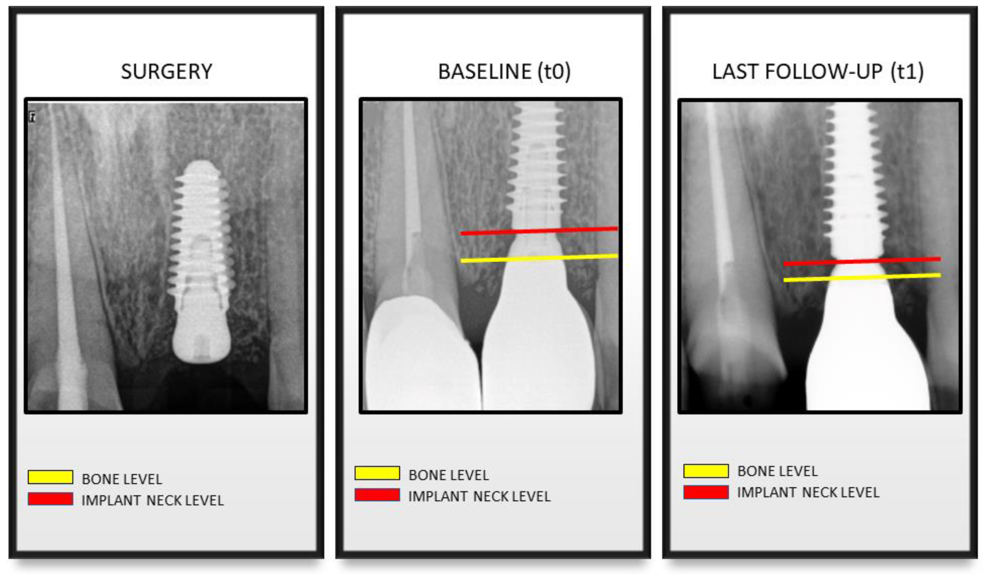 Materials 13 03123 g002 Materials 13 03123 g002