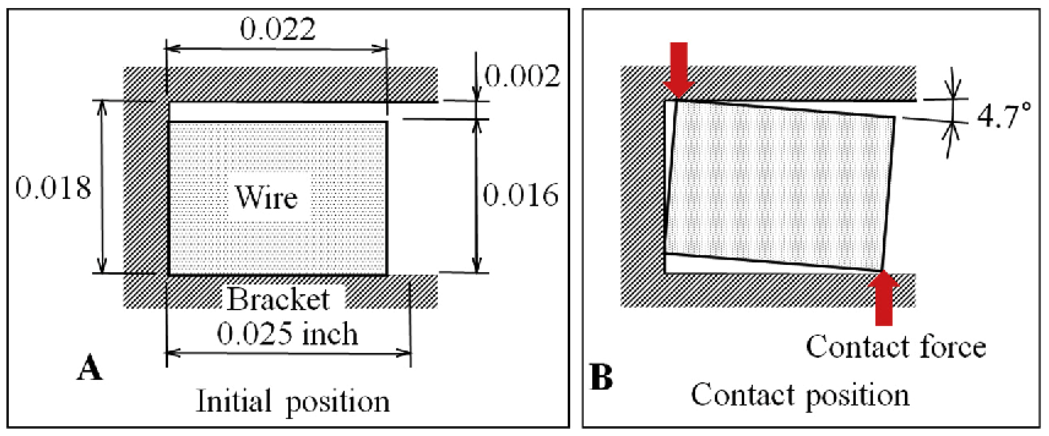 Materials Free Full Text Functional Coatings For Orthodontic Archwires A Review Html Materials Free Full Text Functional Coatings For Orthodontic Archwires A Review Html