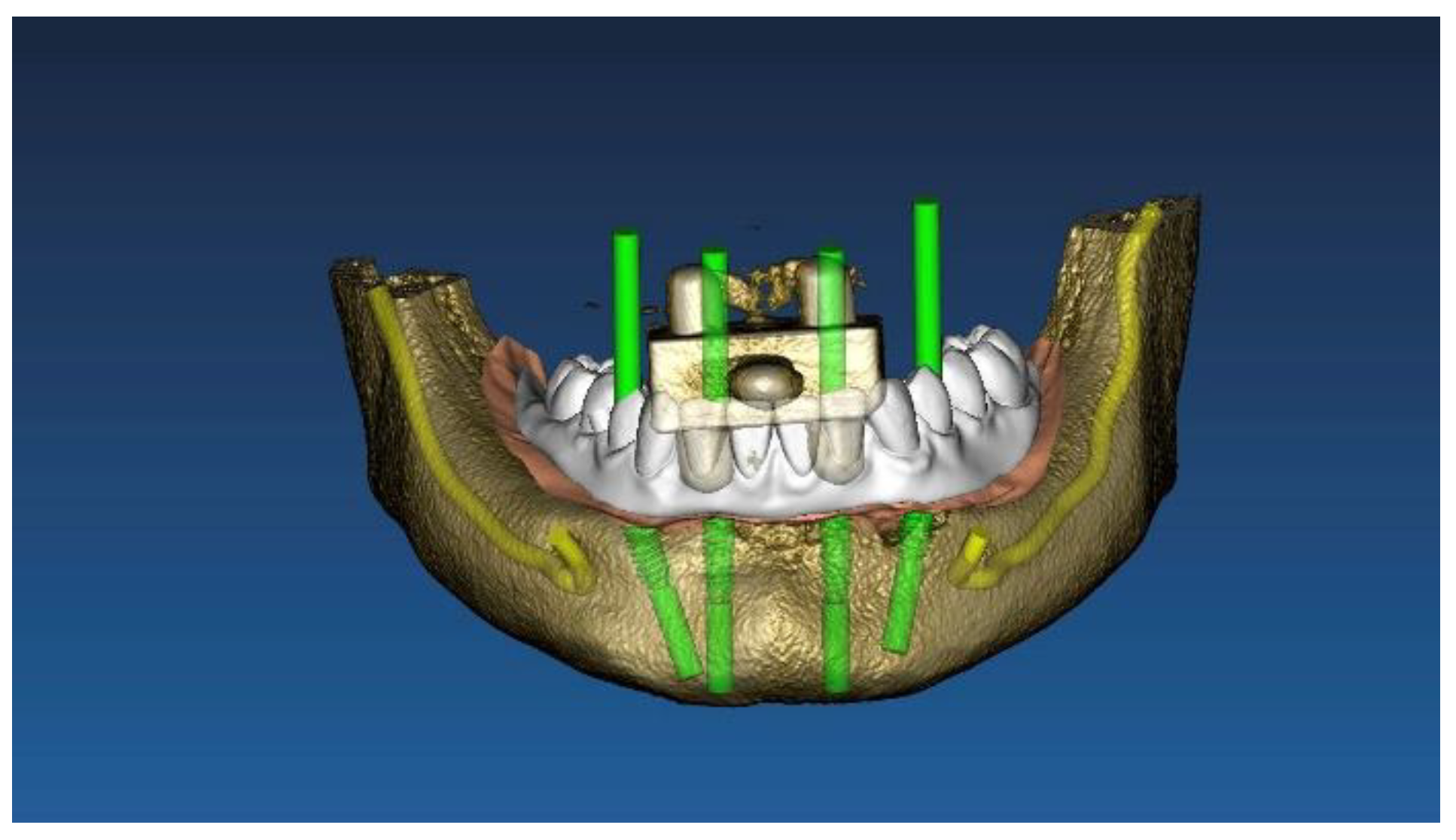 Materials 13 03543 g001 Materials 13 03543 g001