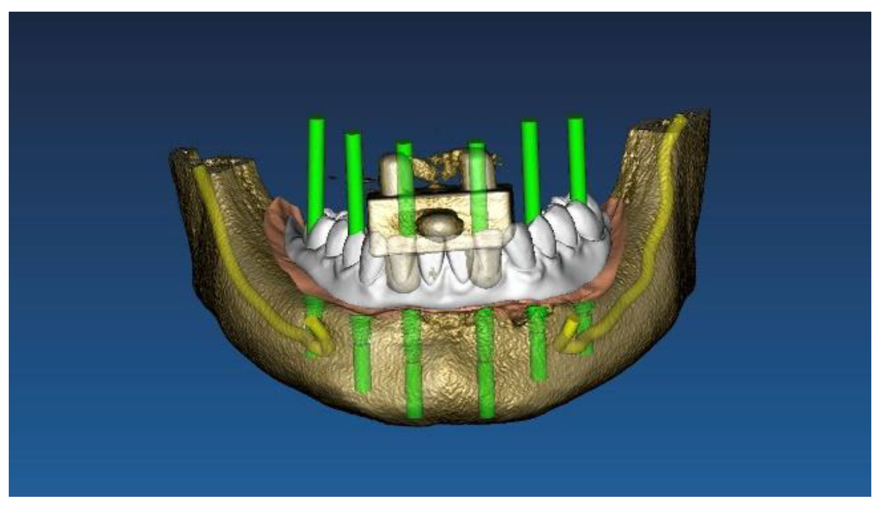 Materials 13 03543 g002 Materials 13 03543 g002