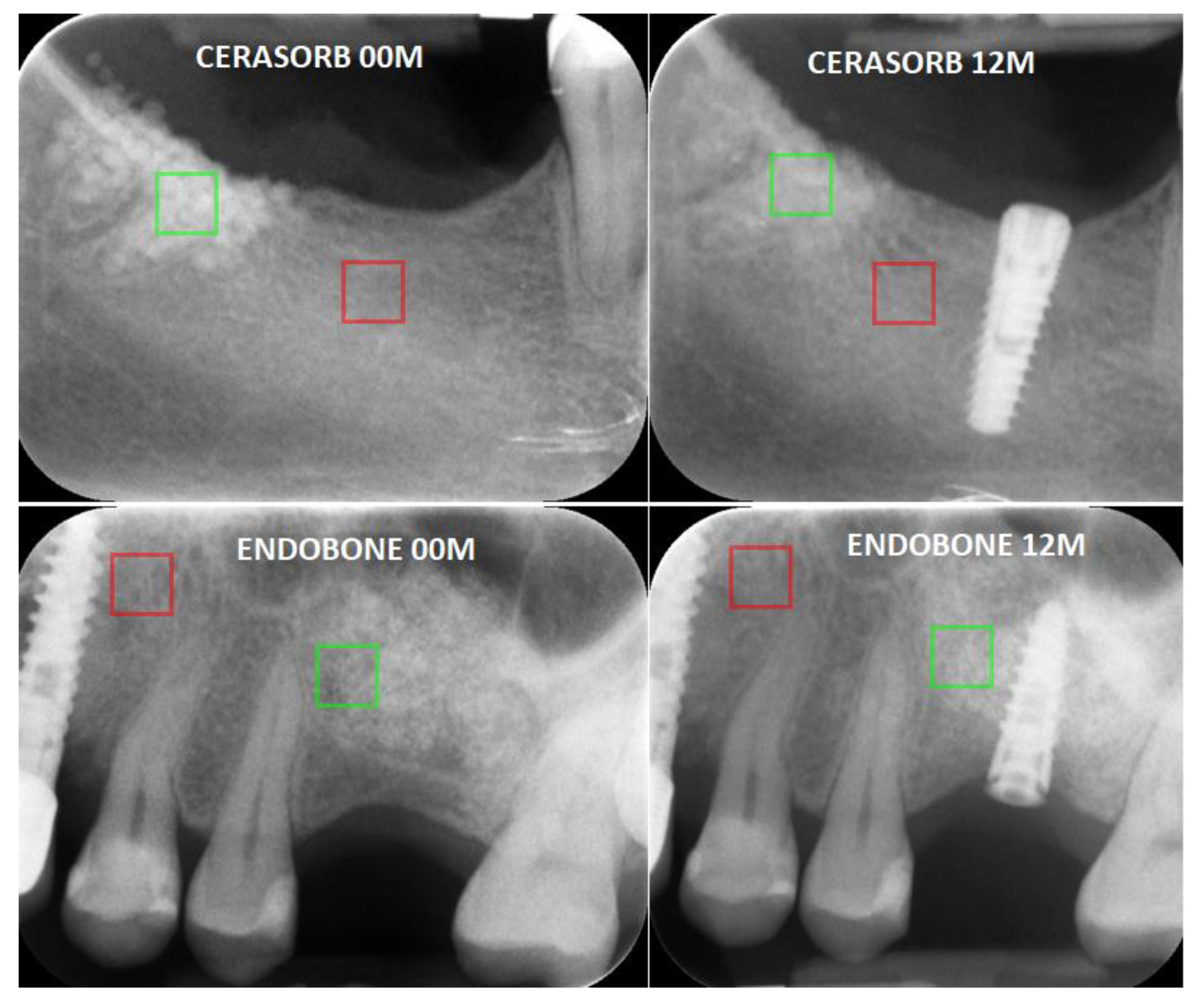 Materials 13 03854 g002