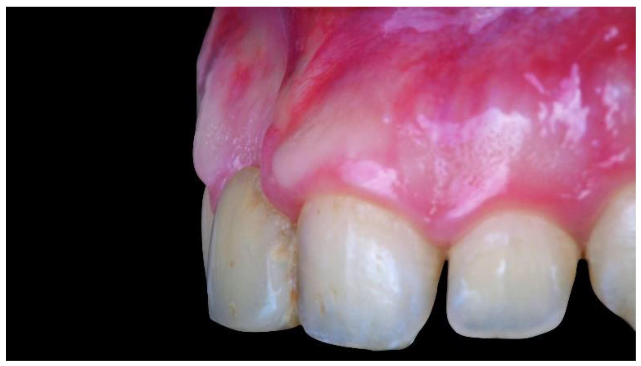 Materials 13 03874 g001 Materials 13 03874 g001