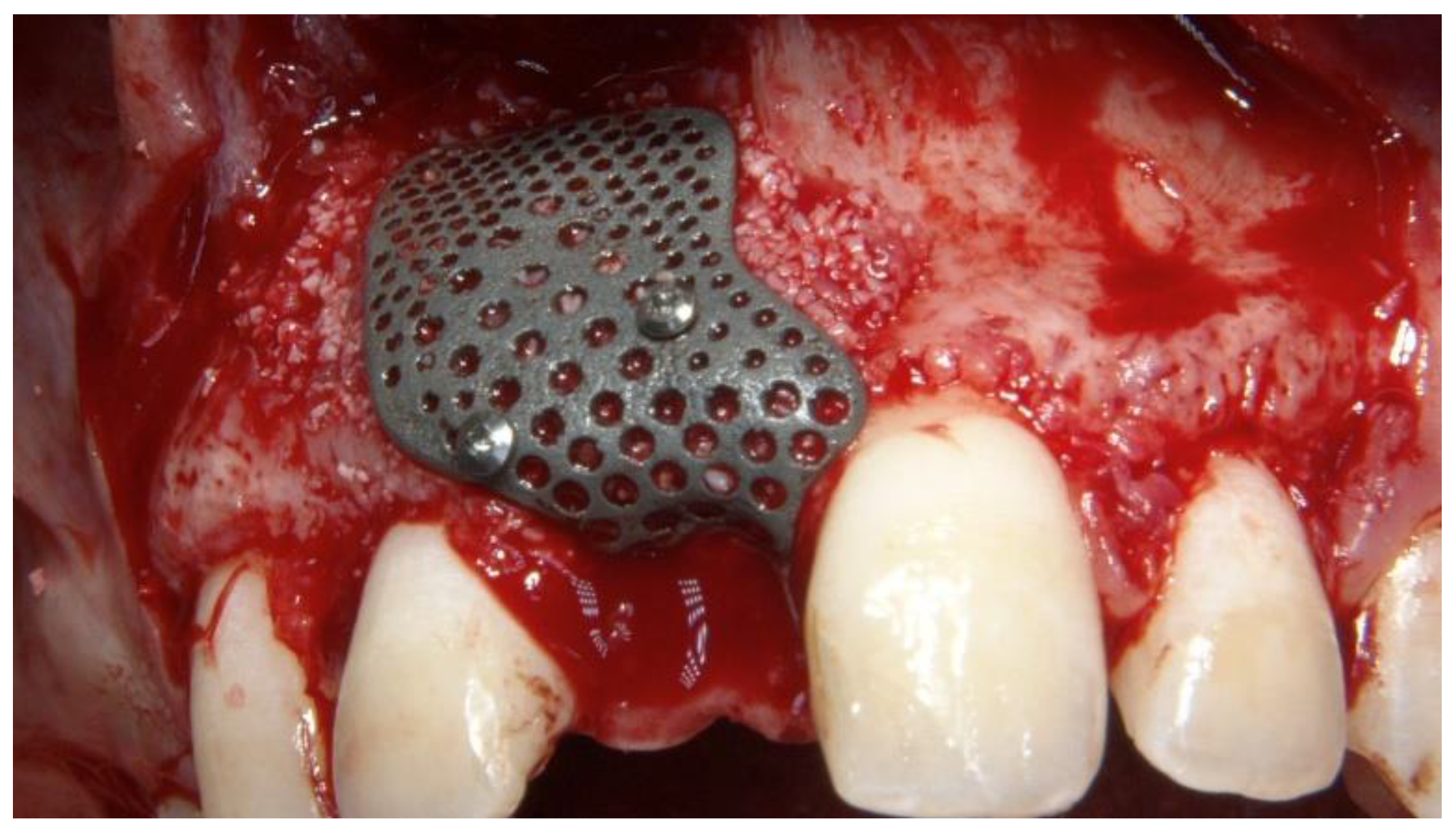 Materials 13 03874 g005 Materials 13 03874 g005