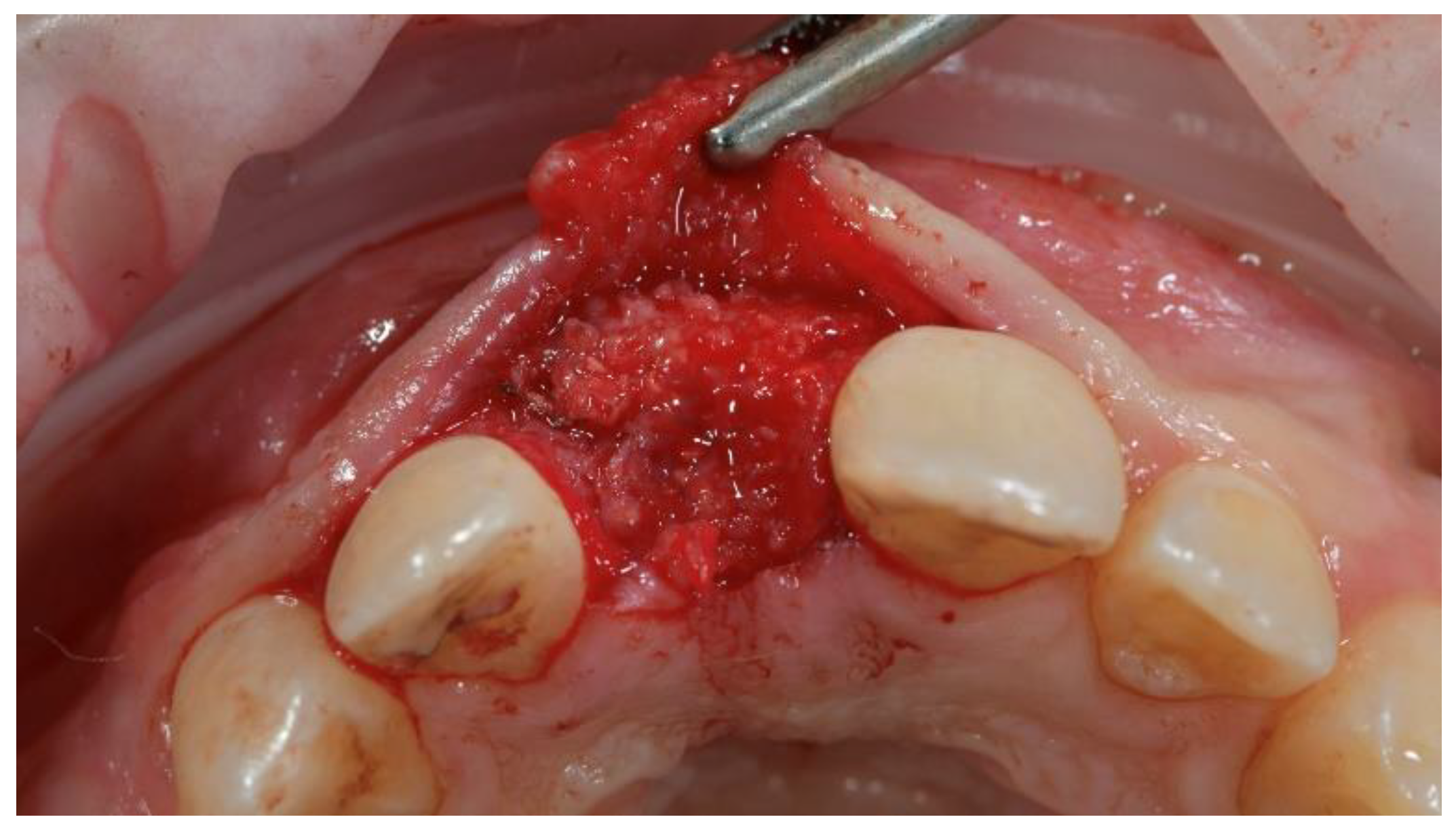 Materials 13 03874 g008 Materials 13 03874 g008