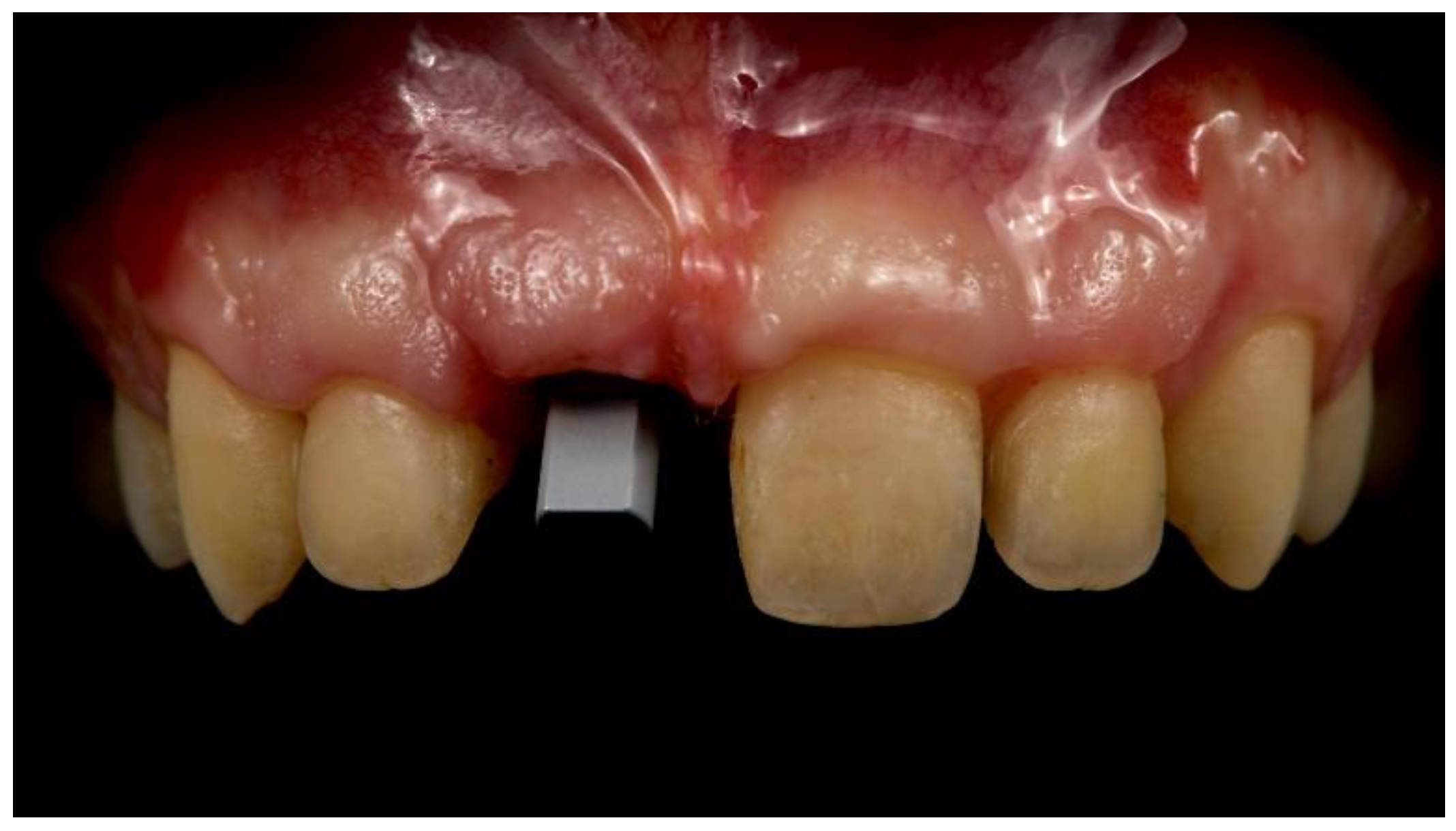 Materials 13 03874 g010 Materials 13 03874 g010