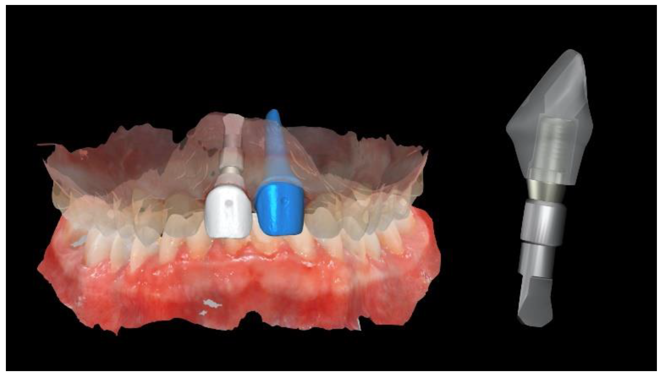 Materials 13 03874 g012 Materials 13 03874 g012