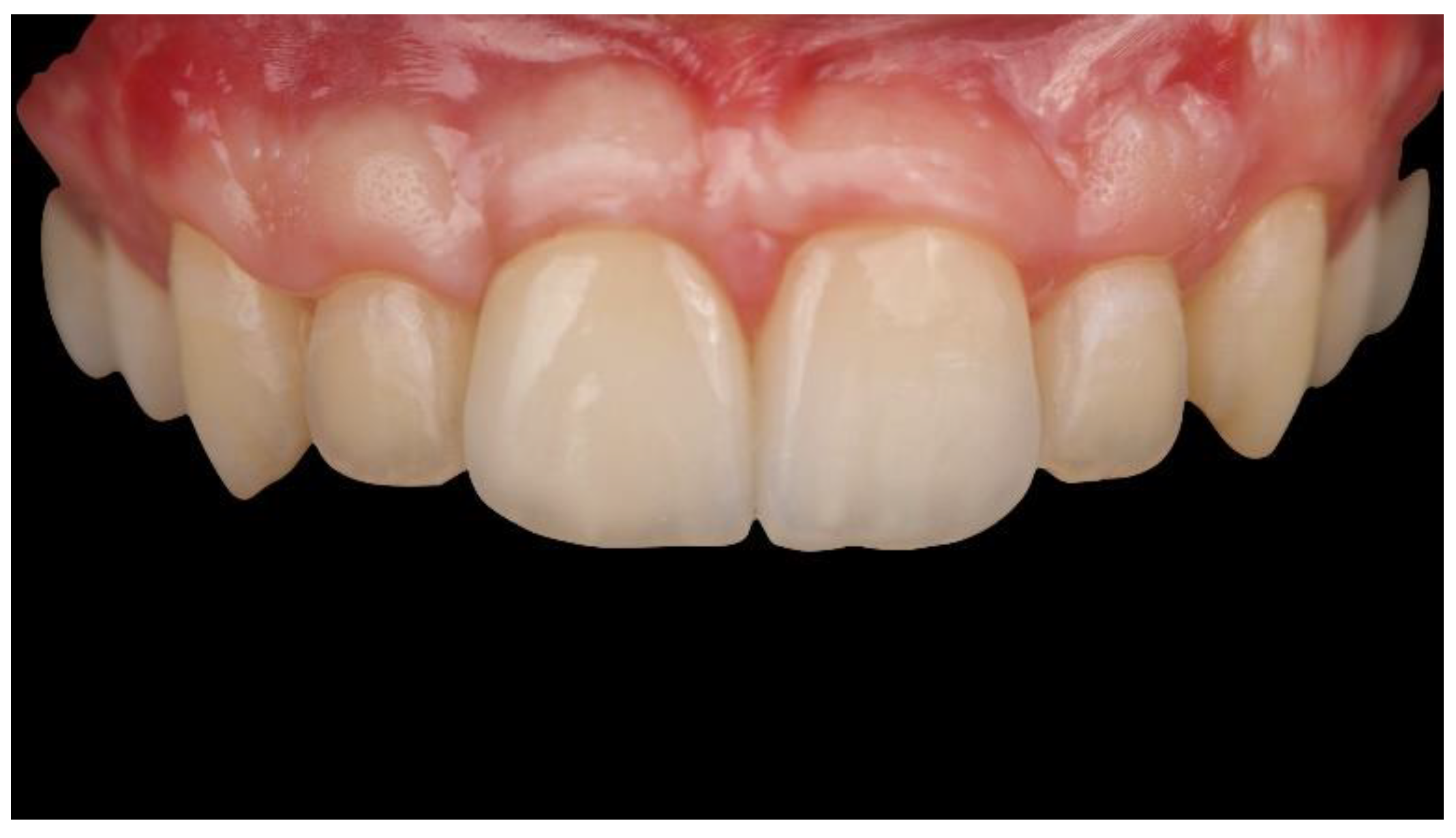 Materials 13 03874 g015 Materials 13 03874 g015