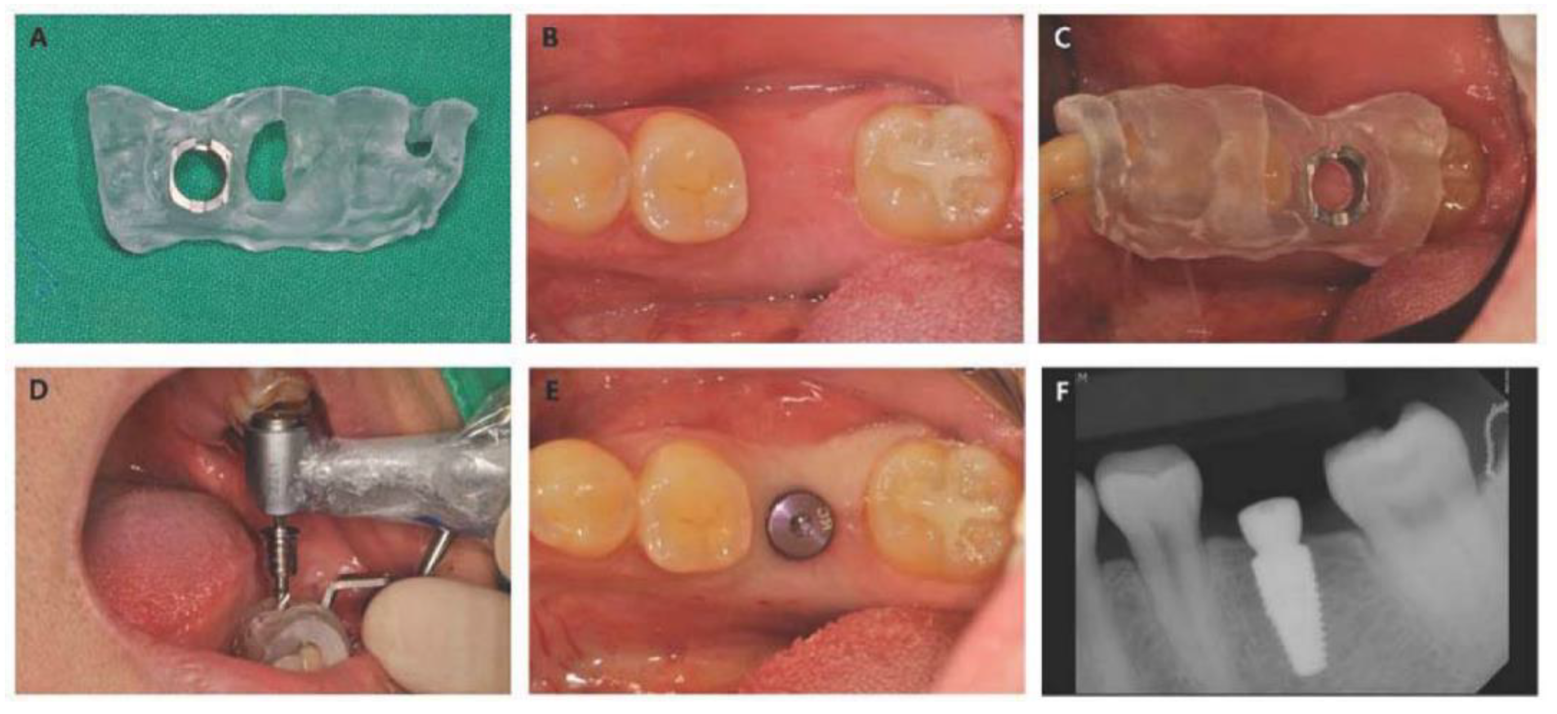 Materials 13 03912 g003