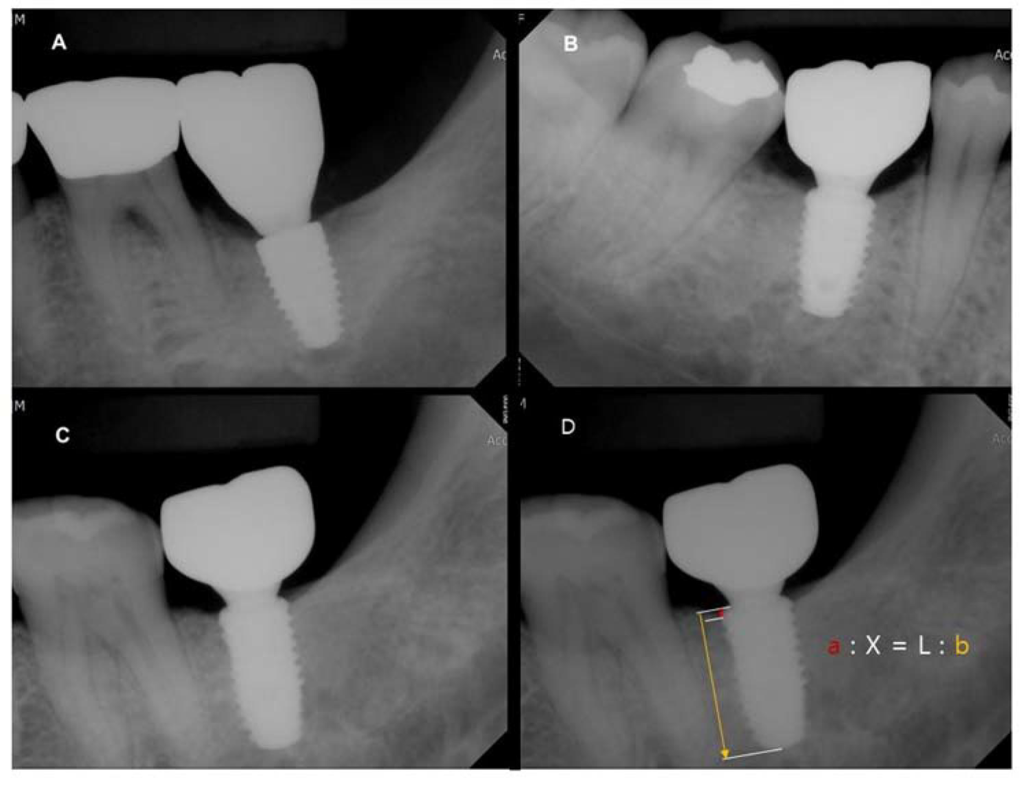 Materials 13 03912 g004
