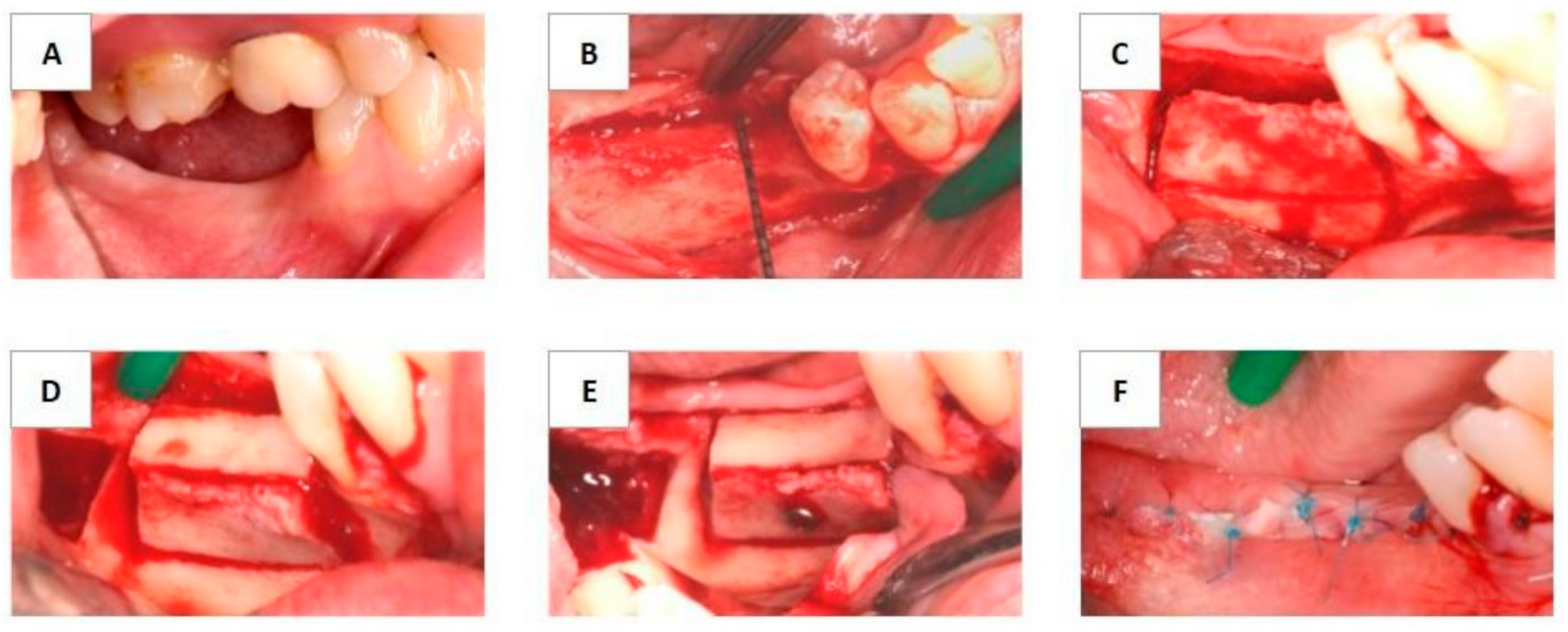 Materials 13 04036 g001