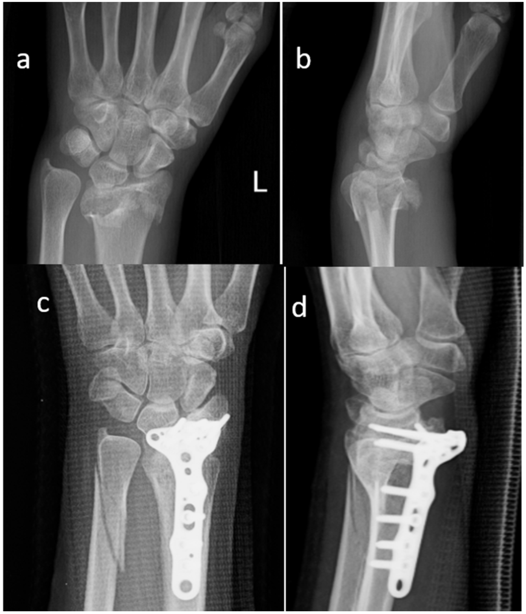 Materials 13 04040 g001