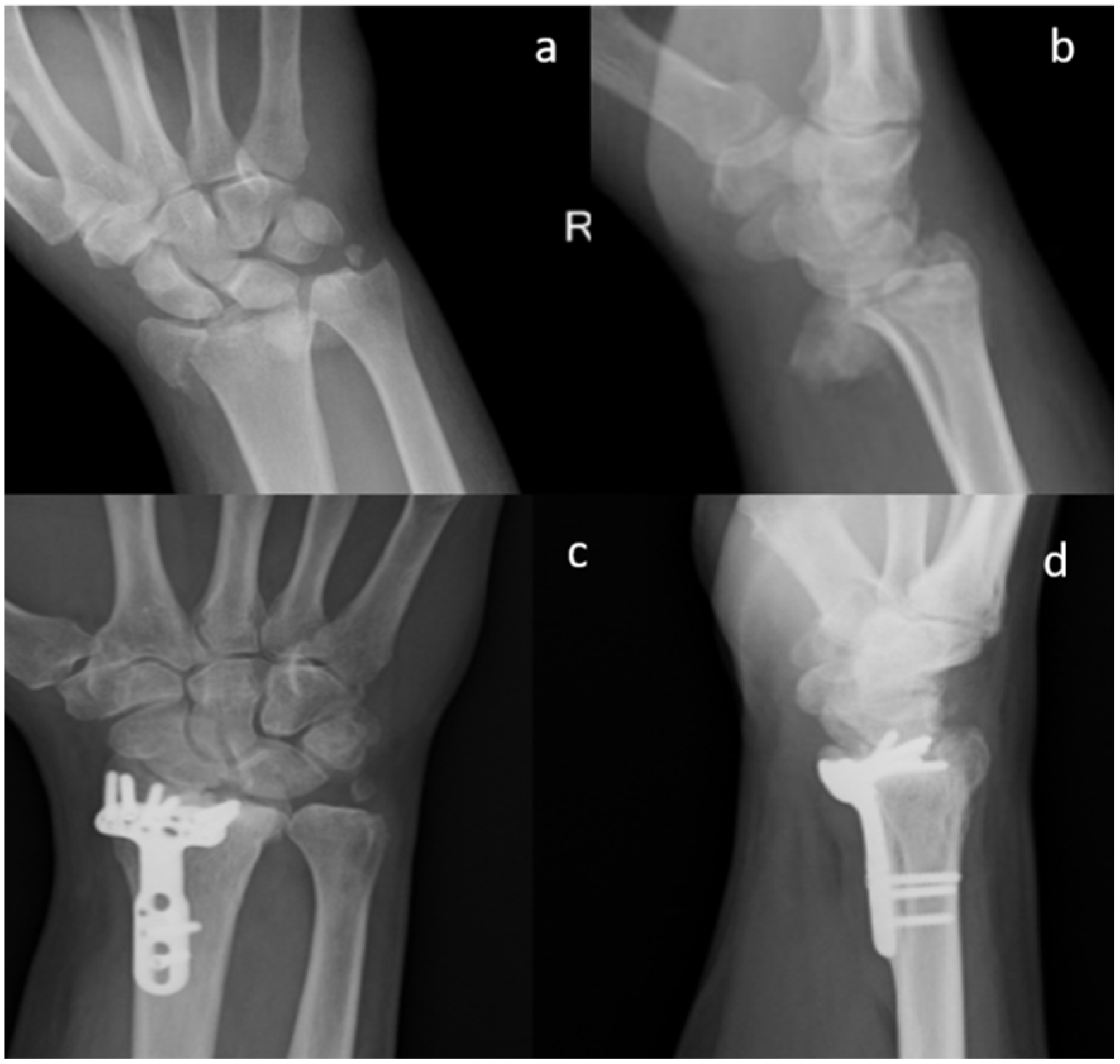 Materials 13 04040 g002