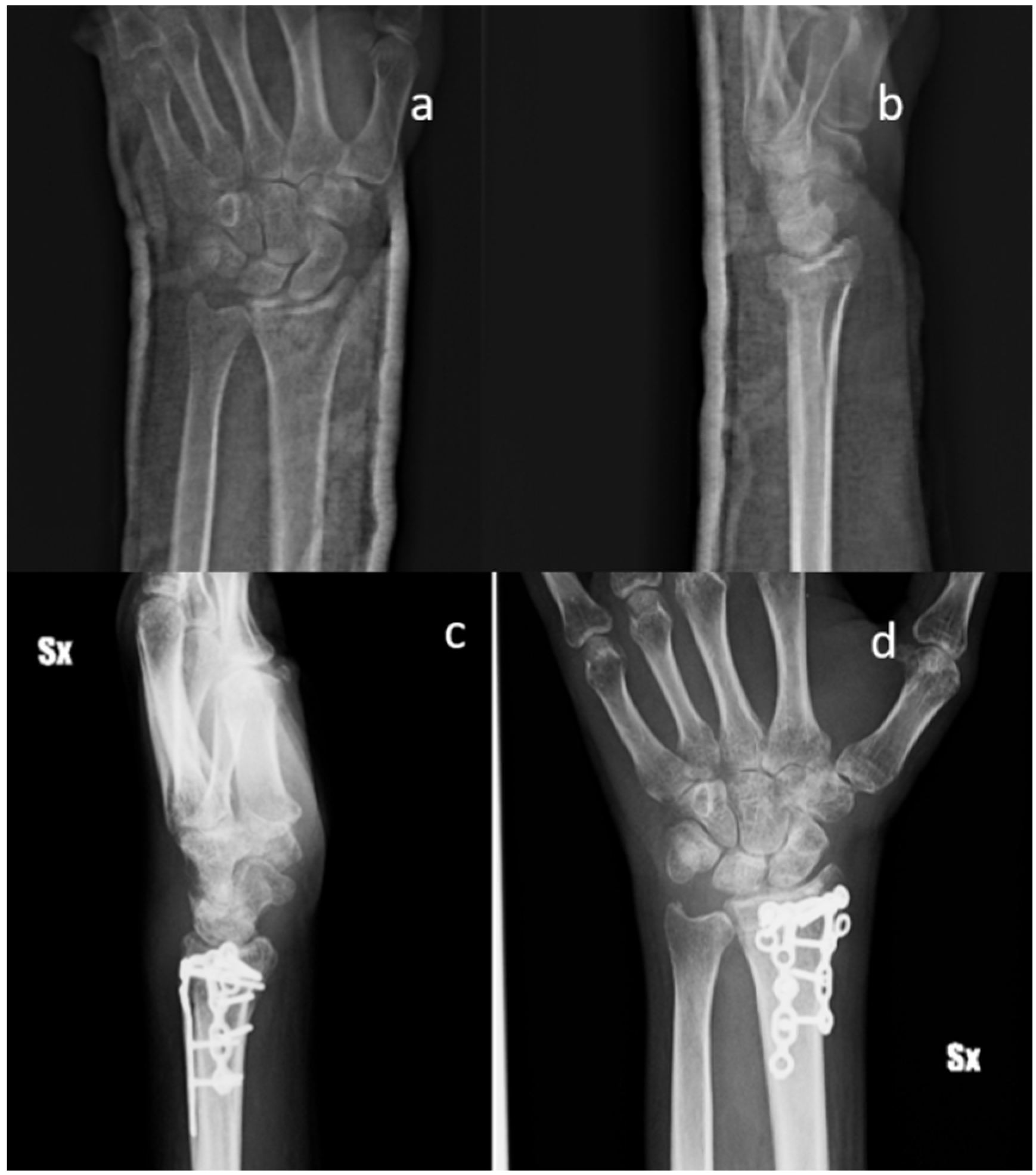 Materials 13 04040 g003