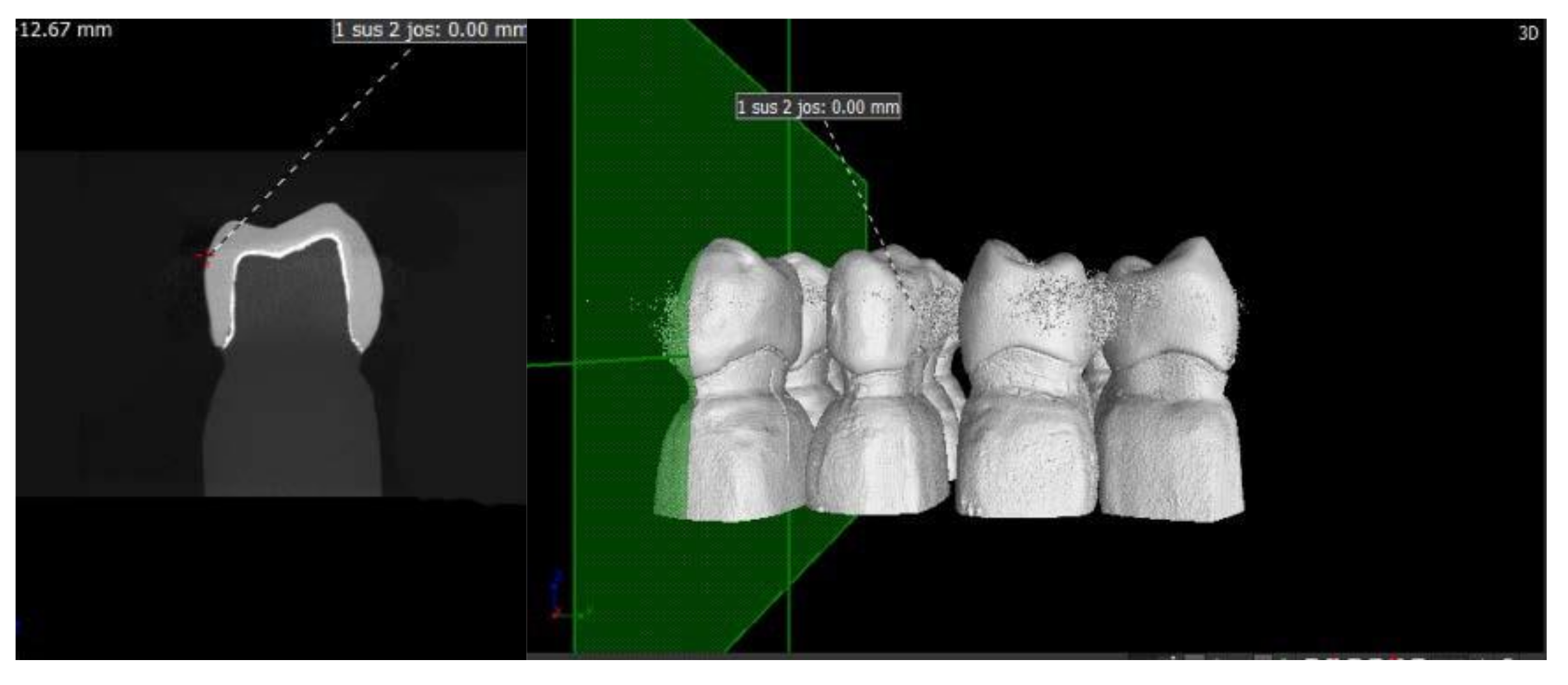 Materials 13 04239 g005