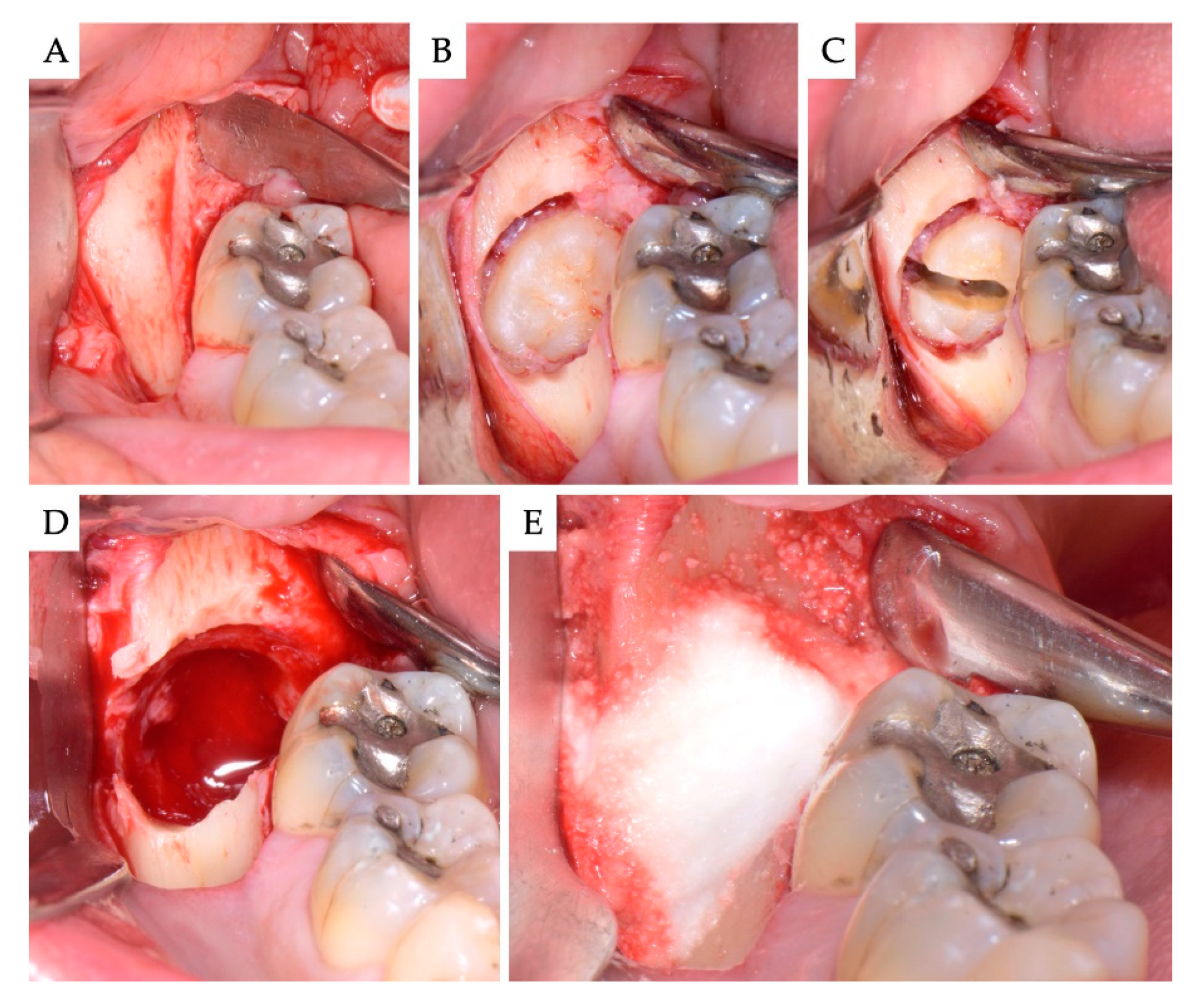 Materials 13 04688 g002 Materials 13 04688 g002