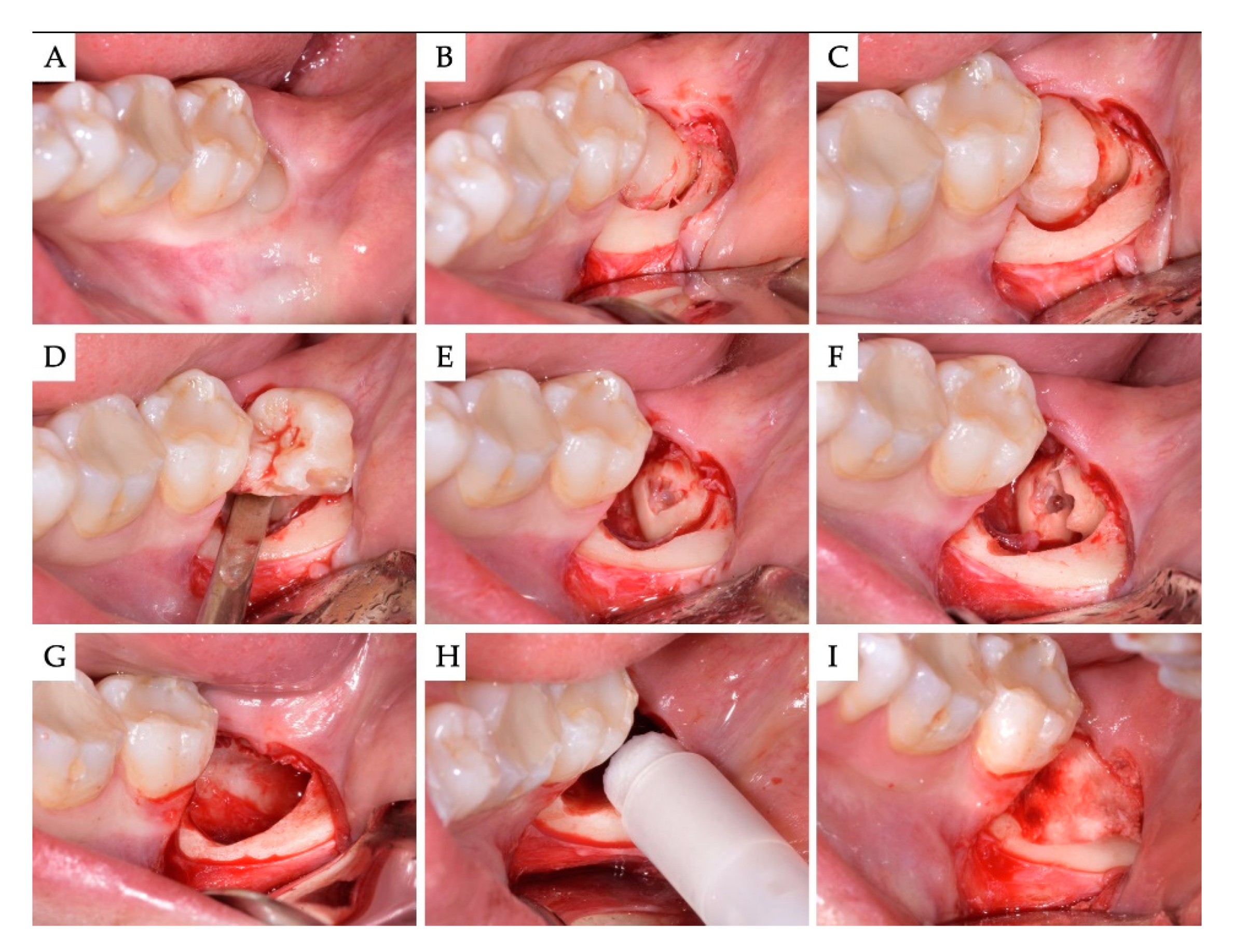 Materials 13 04688 g003 Materials 13 04688 g003