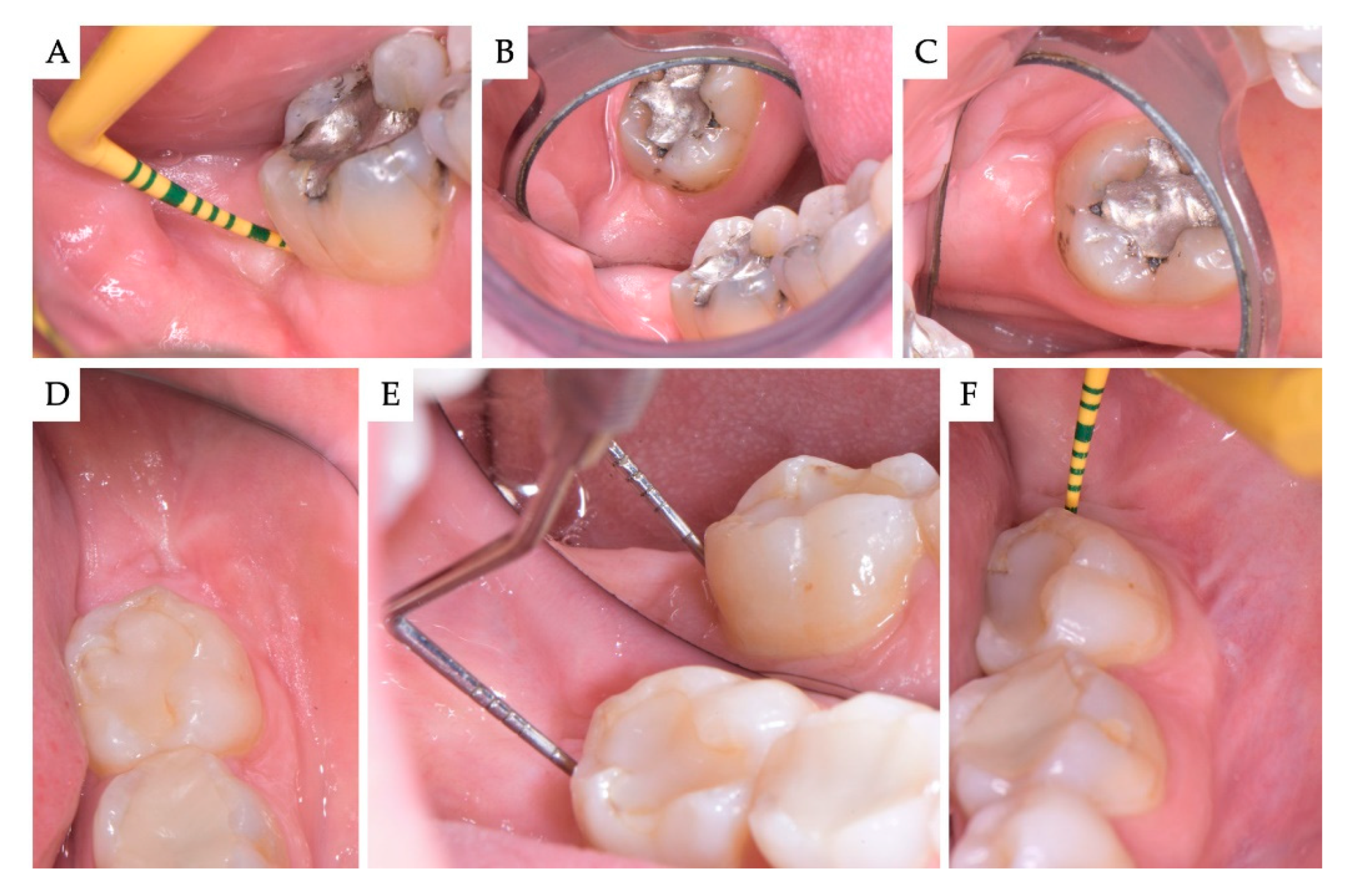 Materials 13 04688 g004 Materials 13 04688 g004