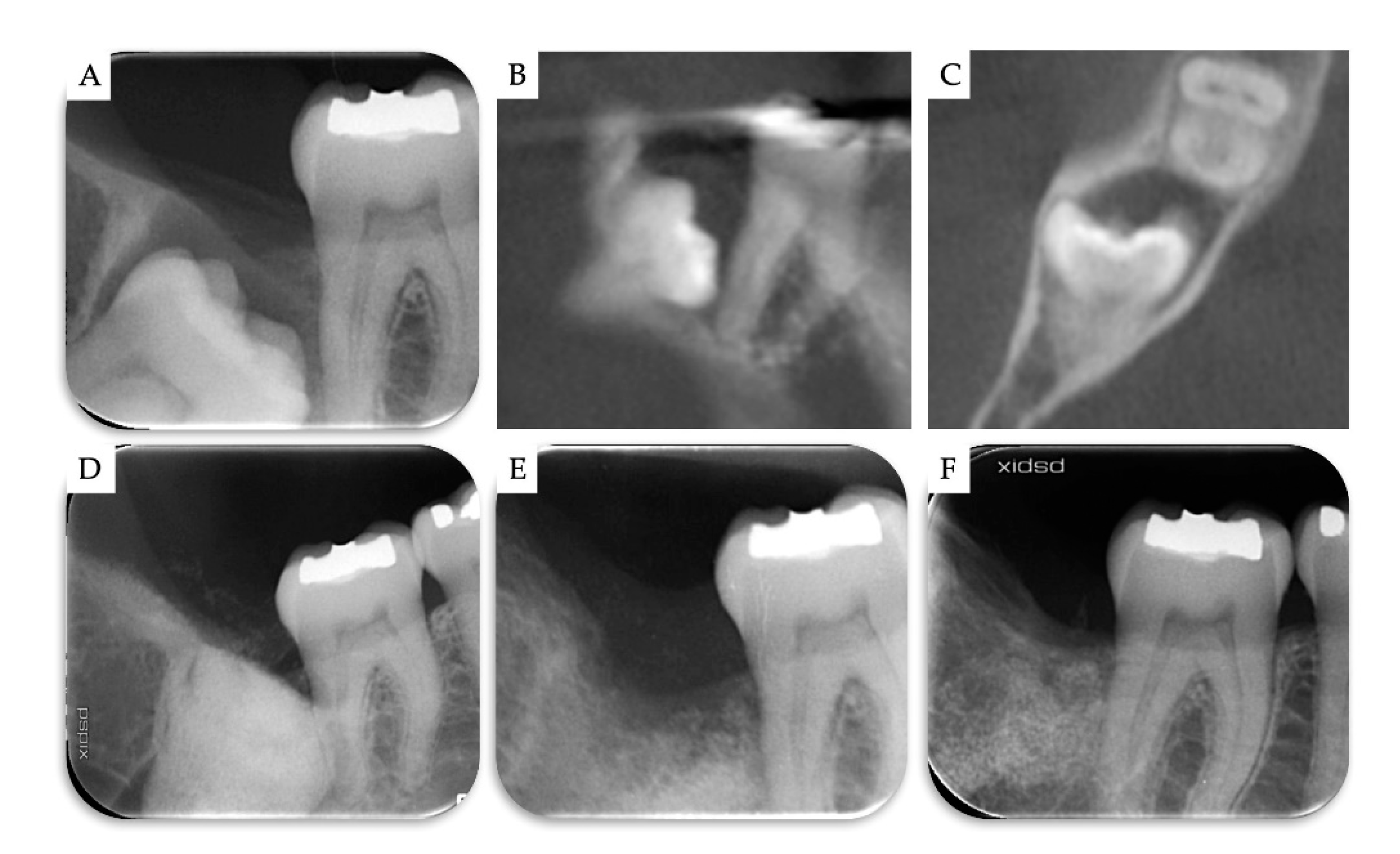 Materials 13 04688 g005 Materials 13 04688 g005