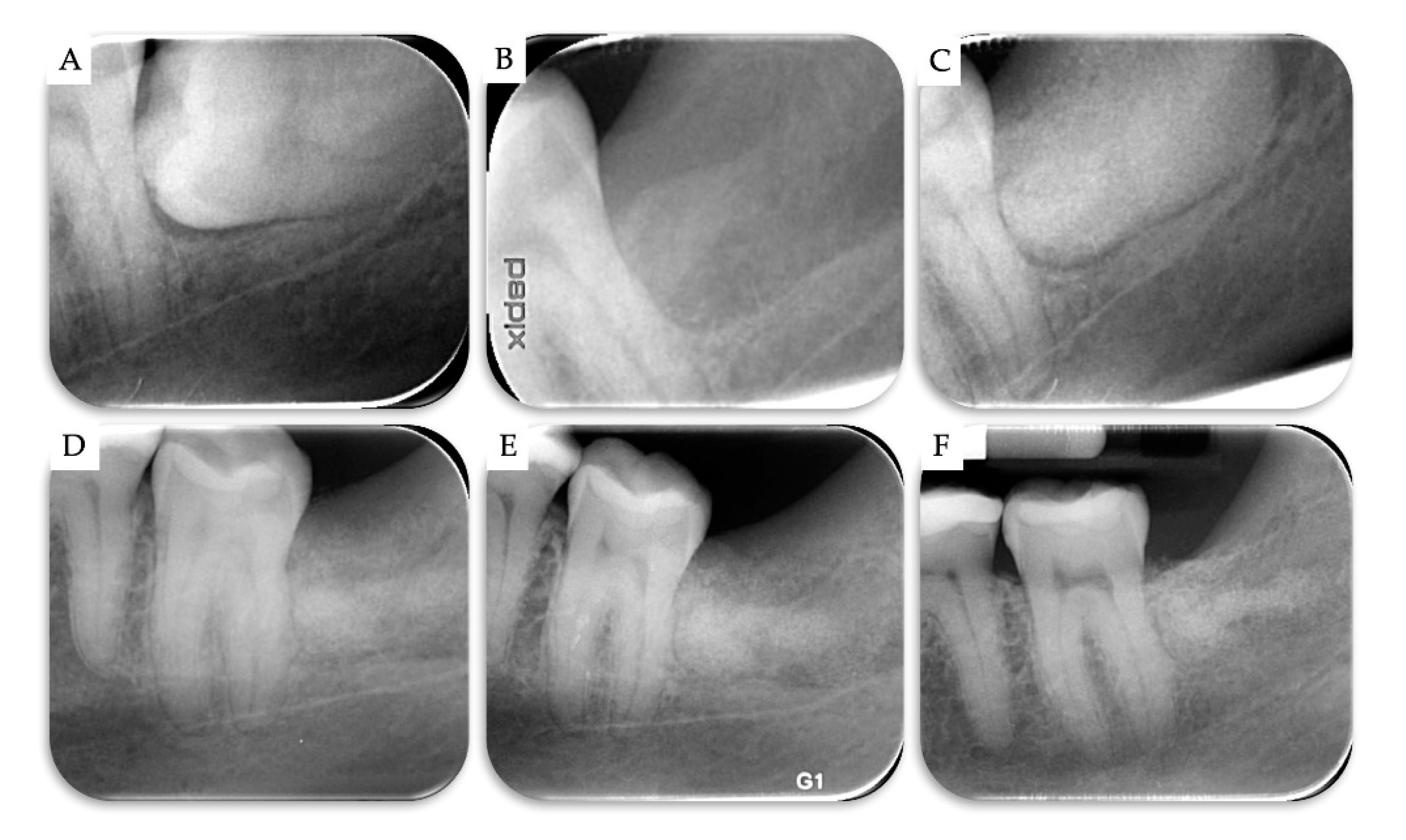 Materials 13 04688 g006 Materials 13 04688 g006