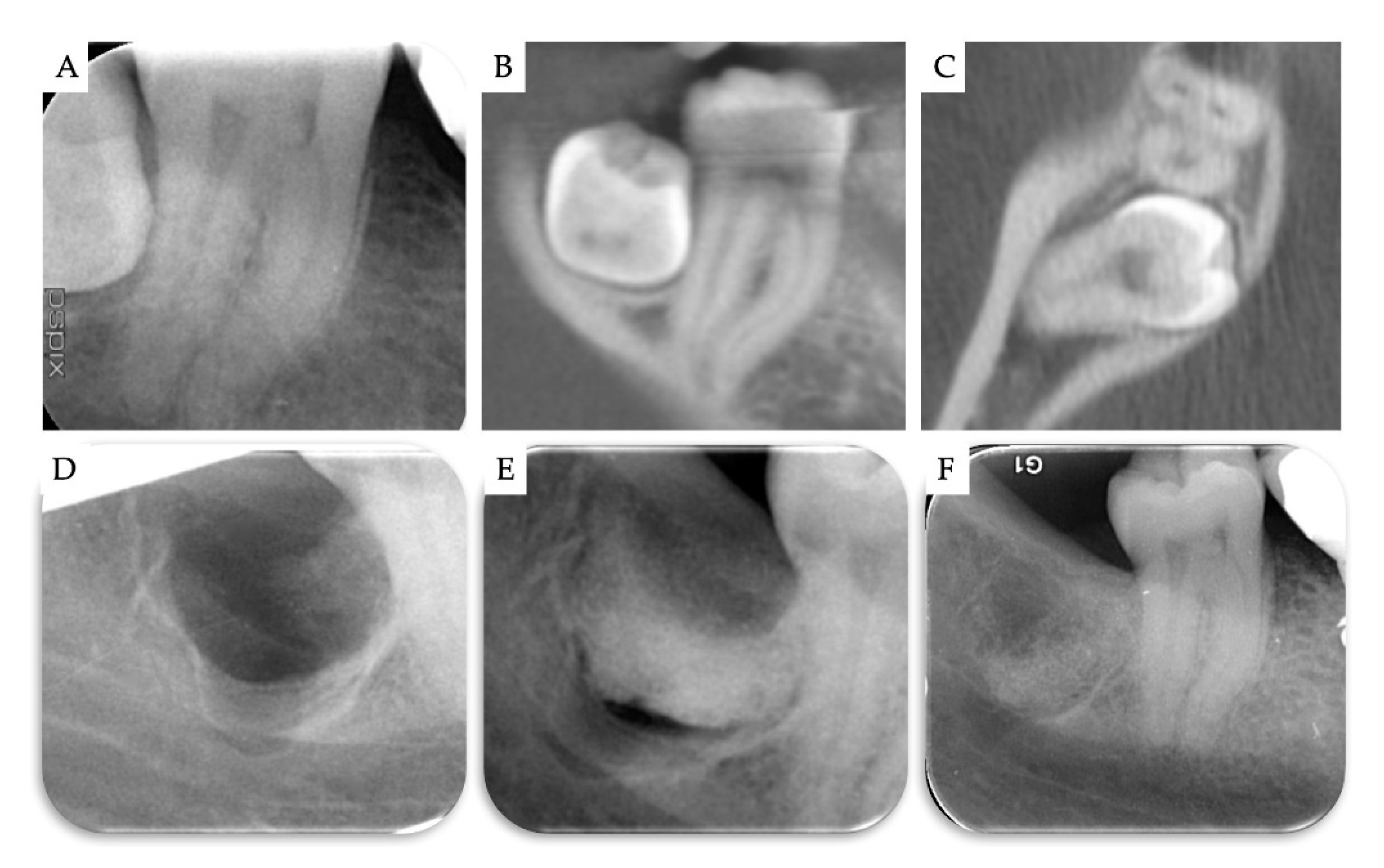 Materials 13 04688 g008 Materials 13 04688 g008