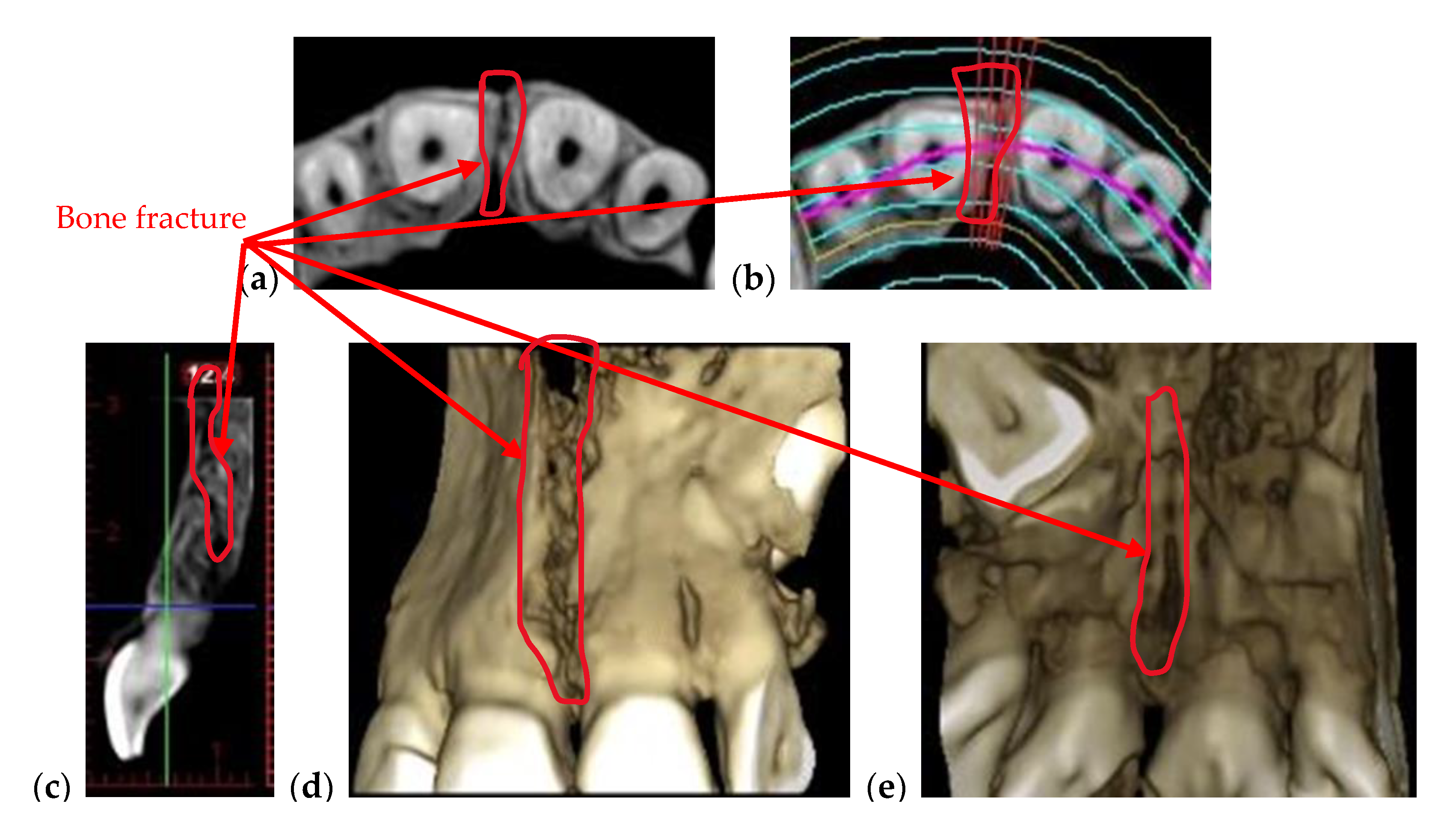 Materials 13 04825 g003 Materials 13 04825 g003