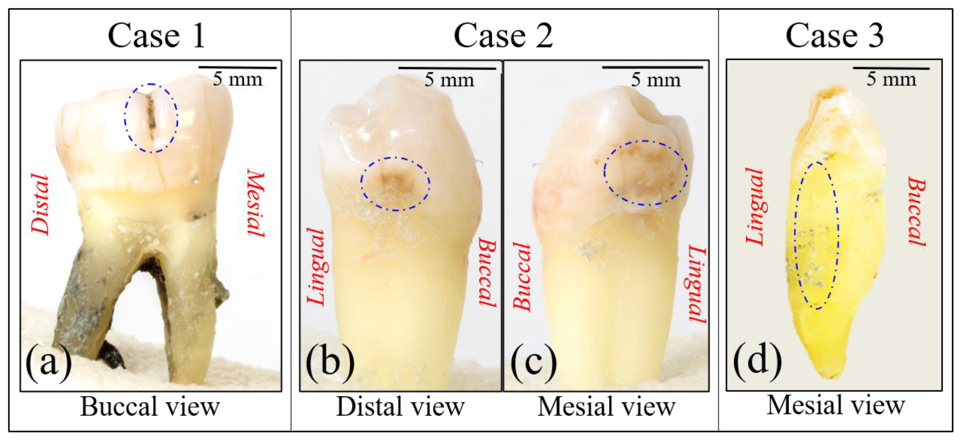 Materials 13 04900 g001