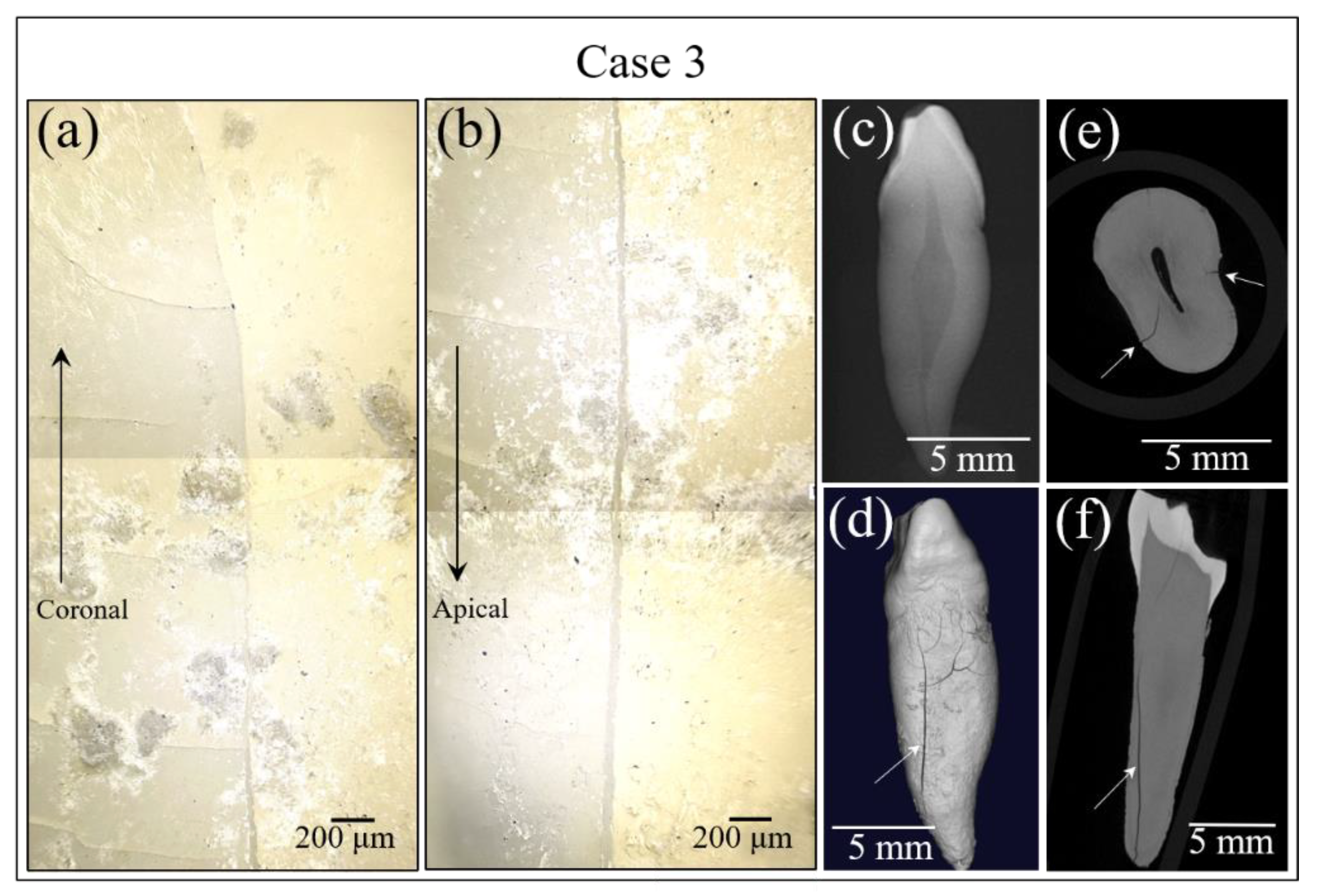 Materials 13 04900 g006