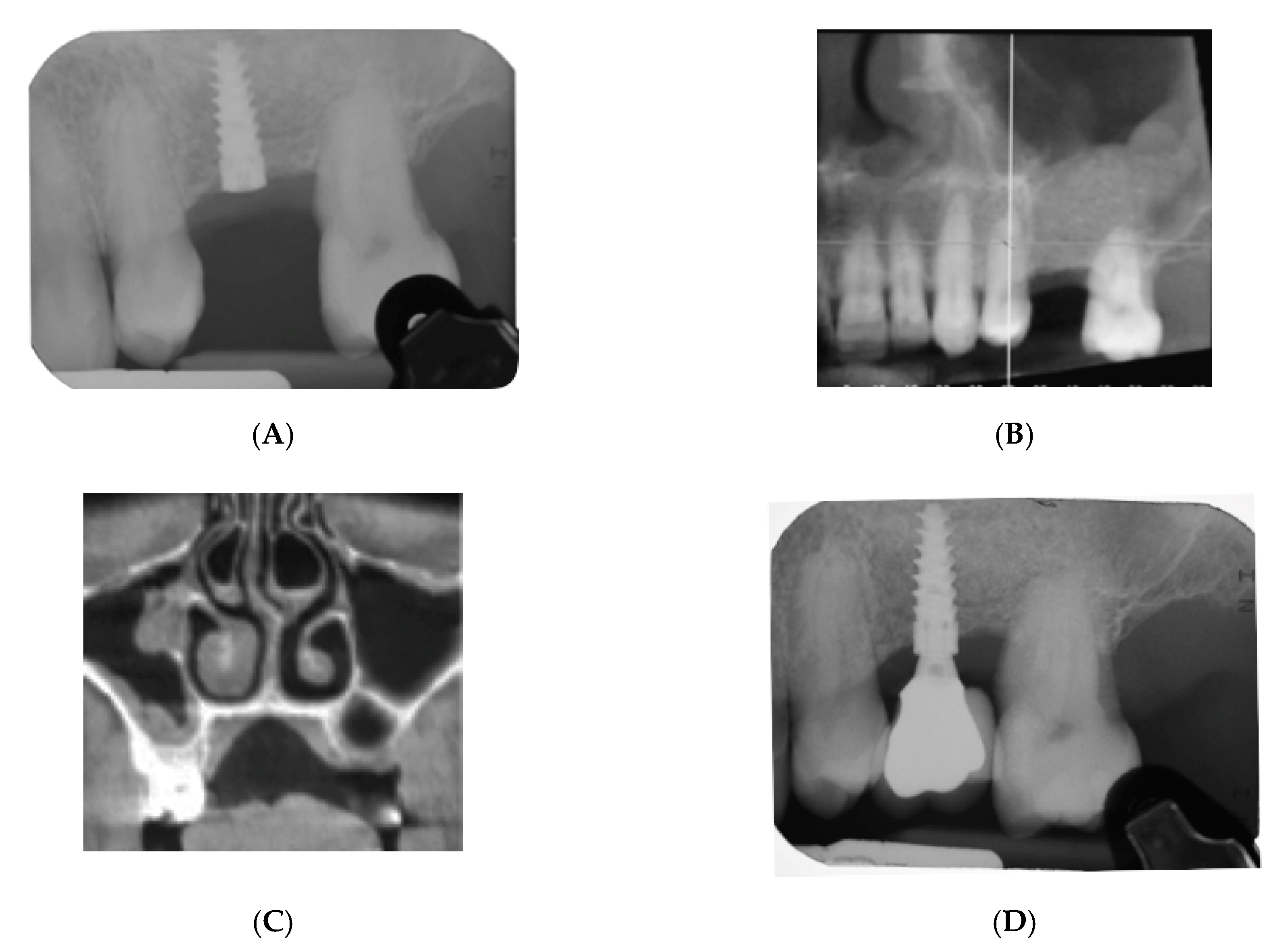 Materials 13 05093 g002